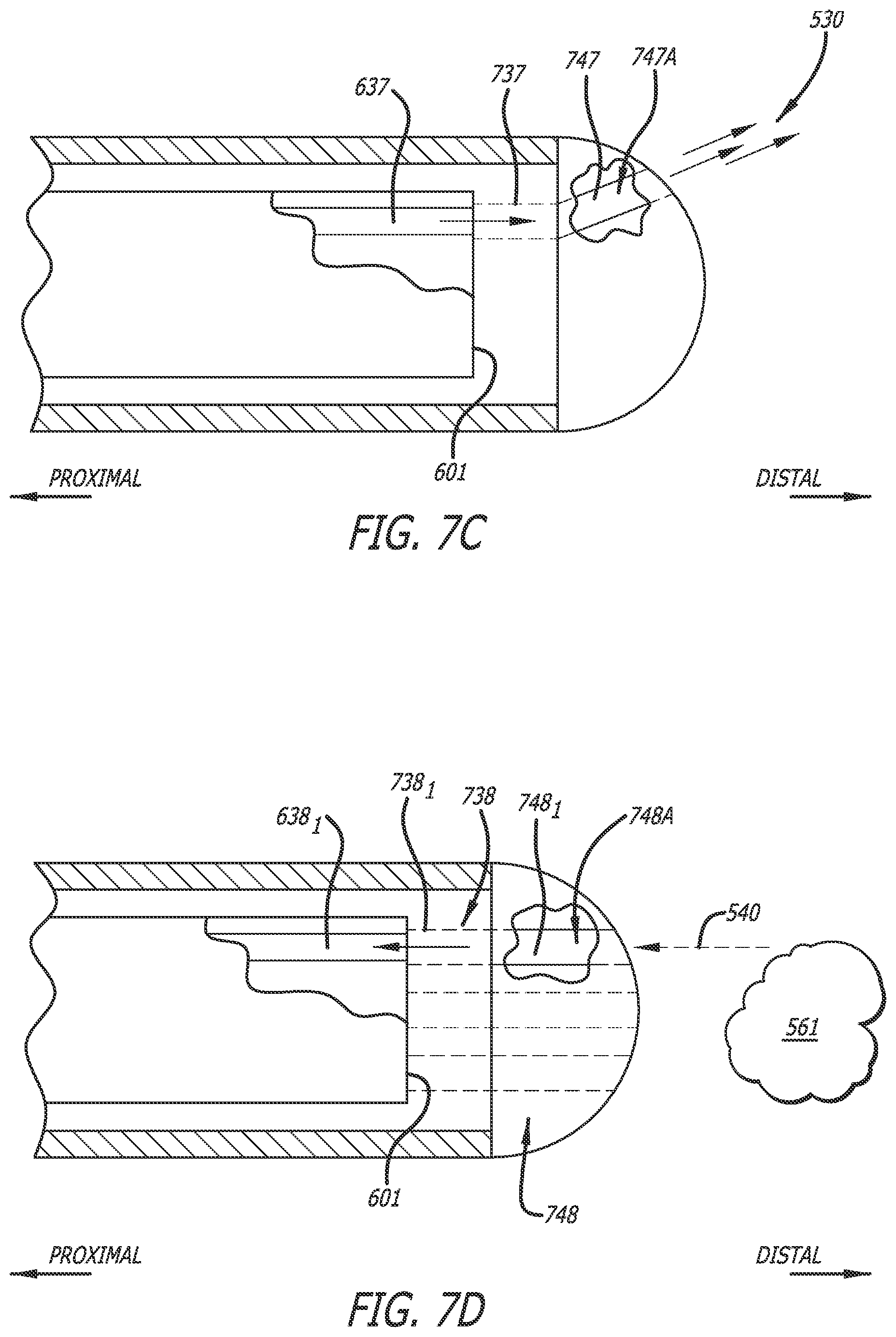 Patent US12426956 Figure 10 – Medical system and method for monitoring medical device insertion and illumination patterns