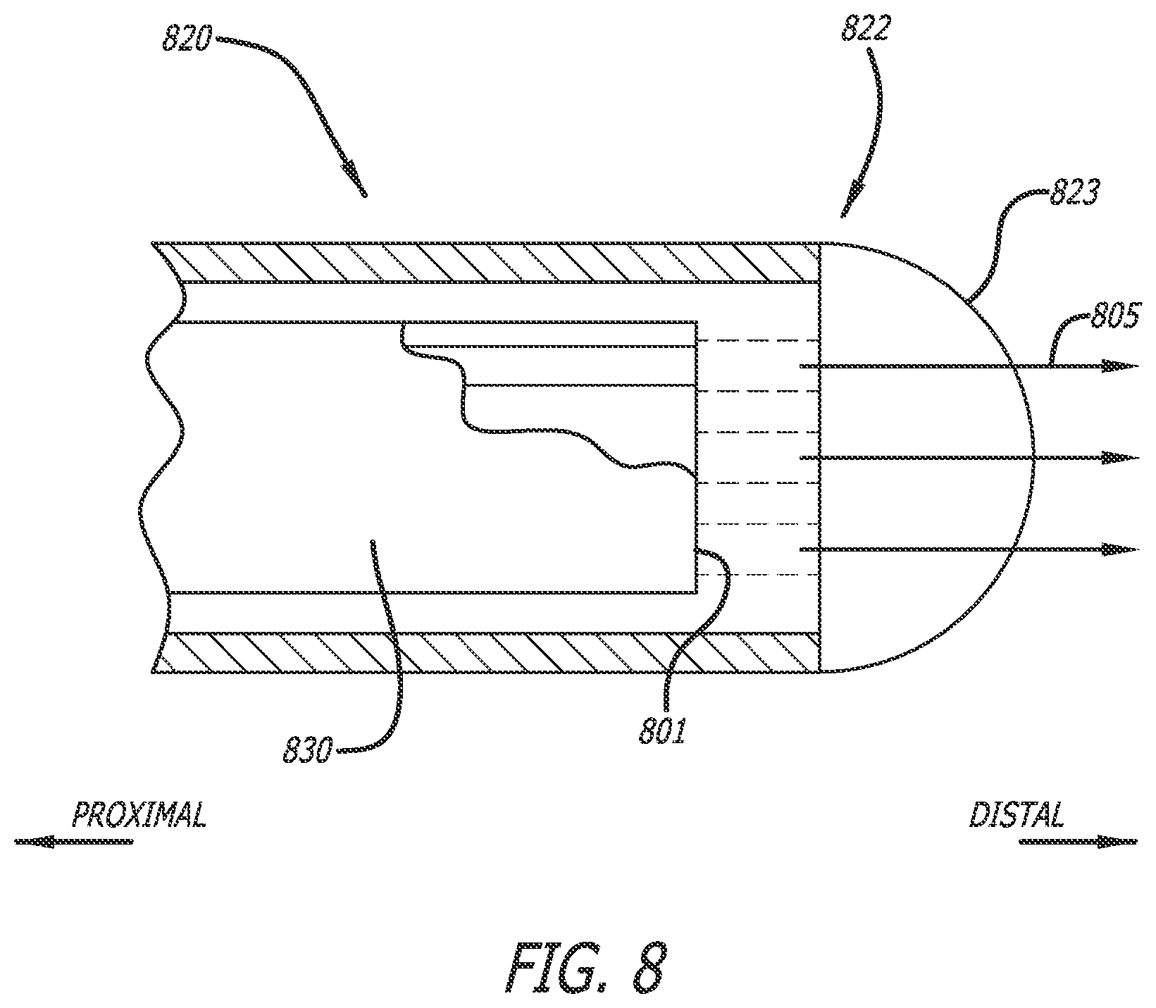 Patent US12426956 Figure 11 – Medical system and method for monitoring medical device insertion and illumination patterns