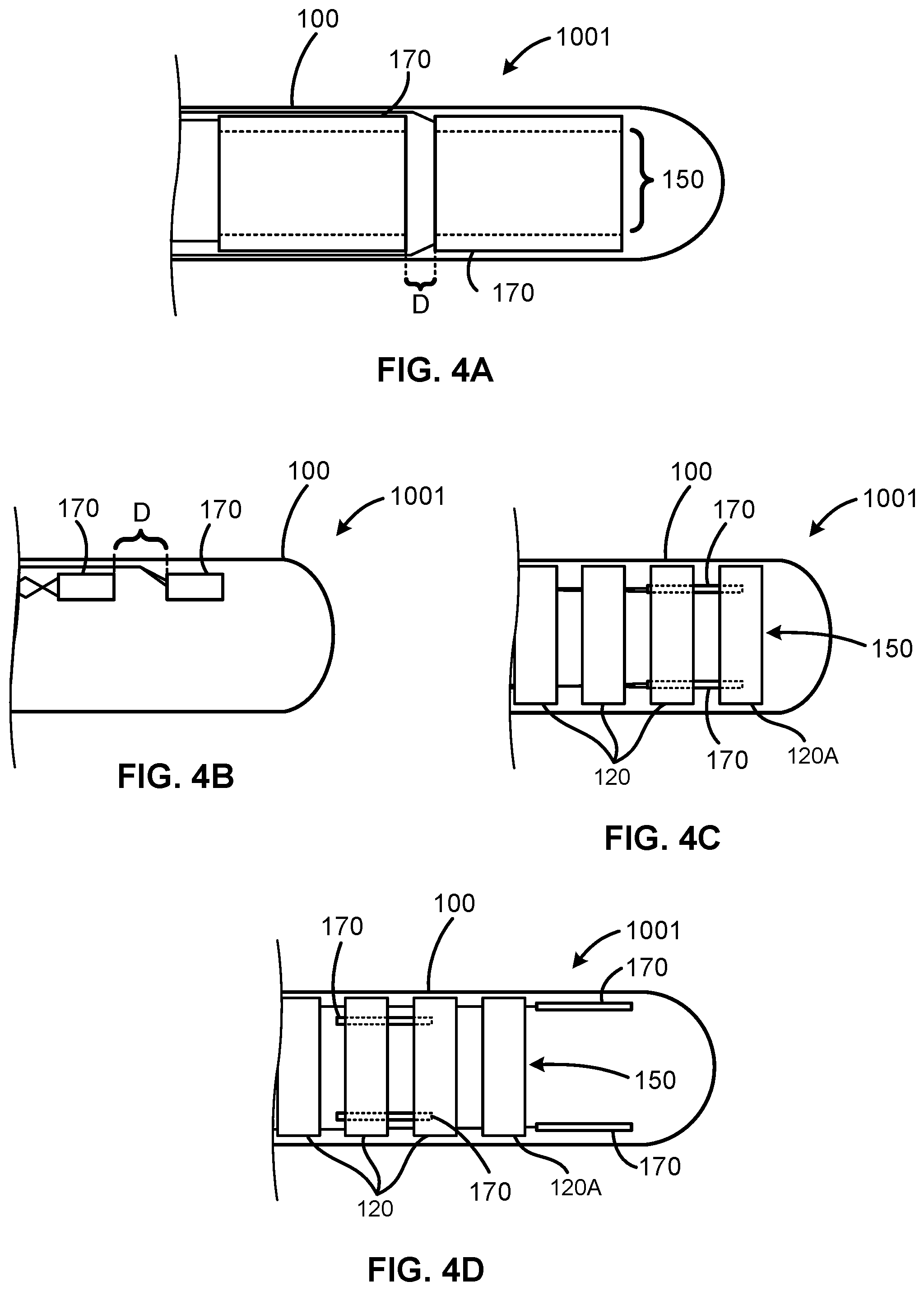 Patent US12426957 Figure 5 – Bendable medical device with multiple position sensors