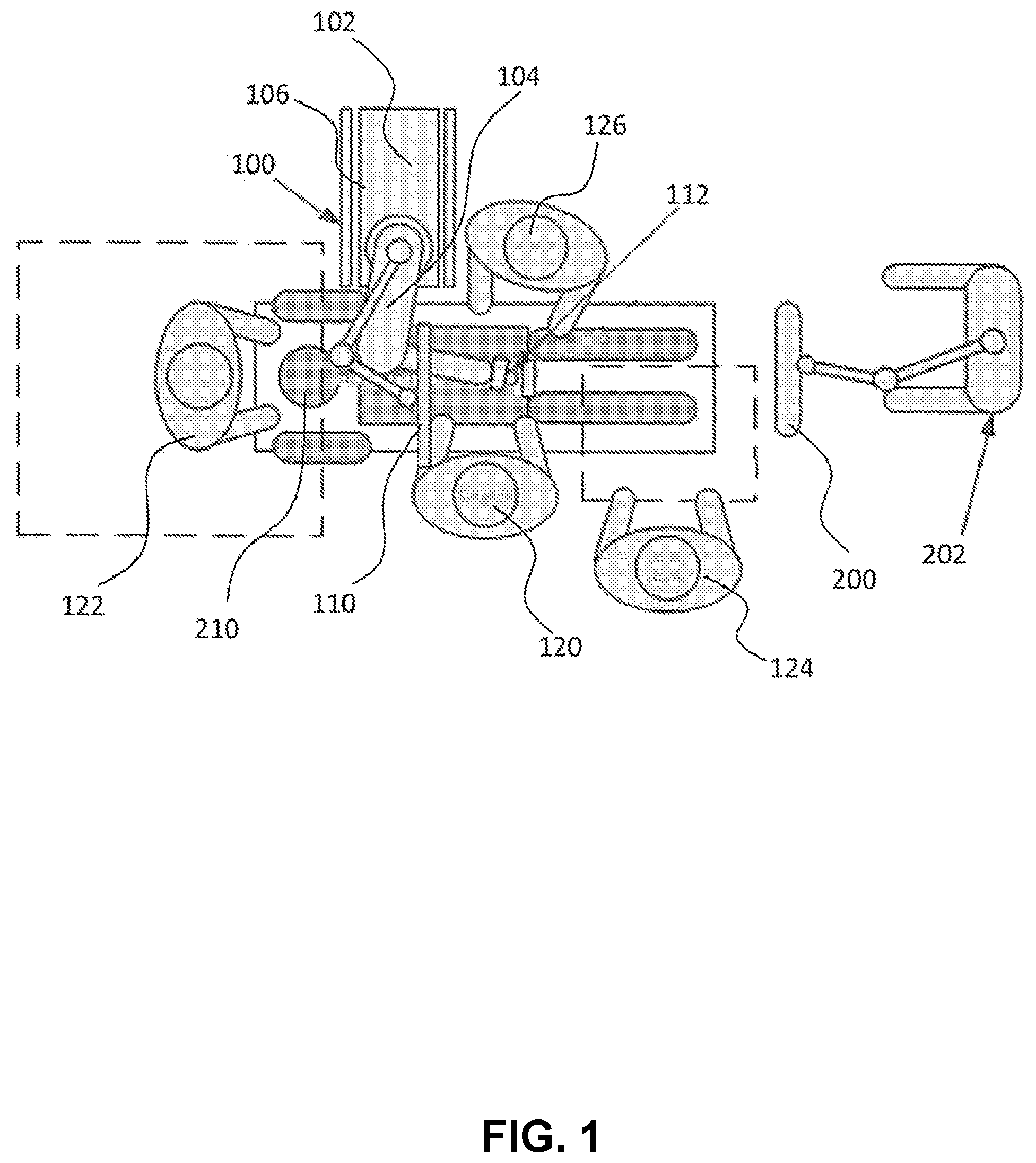 Patent US12426958 Figure 1 – Navigated pelvic implant system and associated method of use