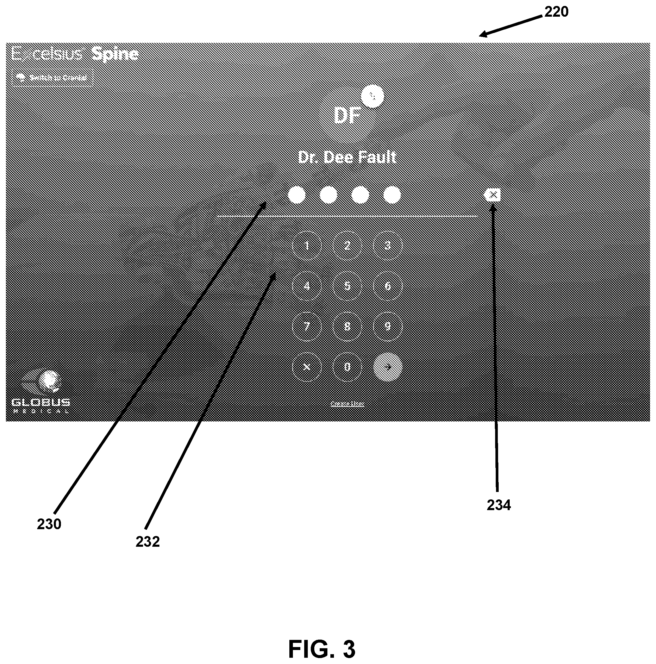 Patent US12426958 Figure 3 – Navigated pelvic implant system and associated method of use