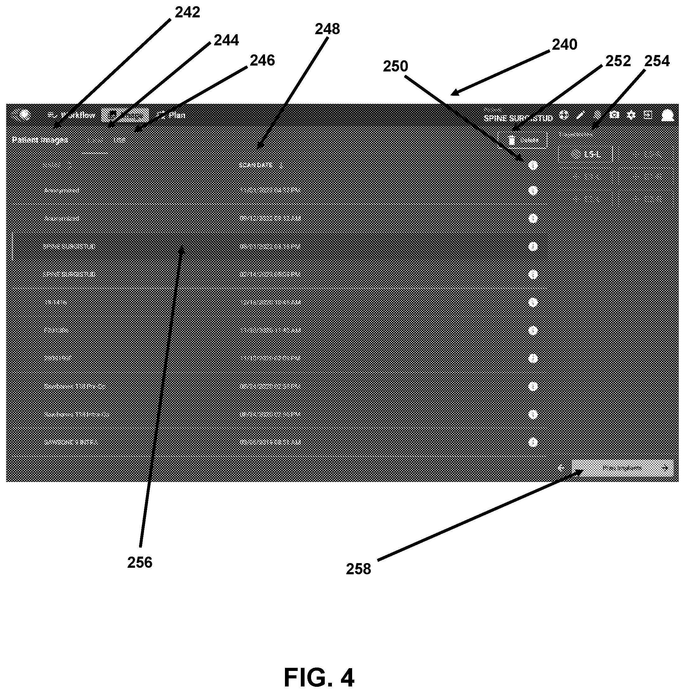 Patent US12426958 Figure 4 – Navigated pelvic implant system and associated method of use