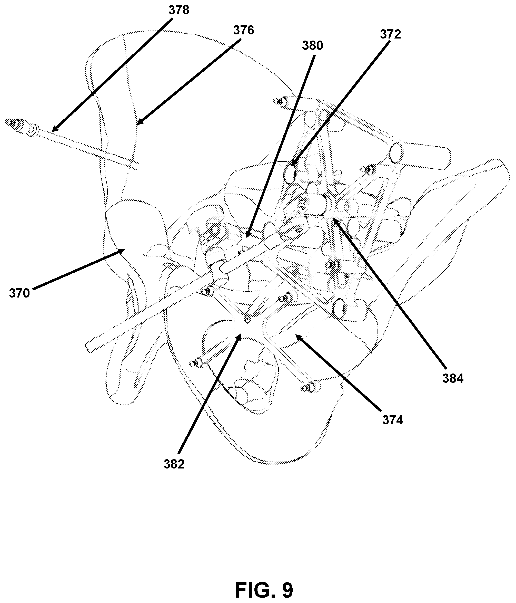 Patent US12426958 Figure 9 – Navigated pelvic implant system and associated method of use