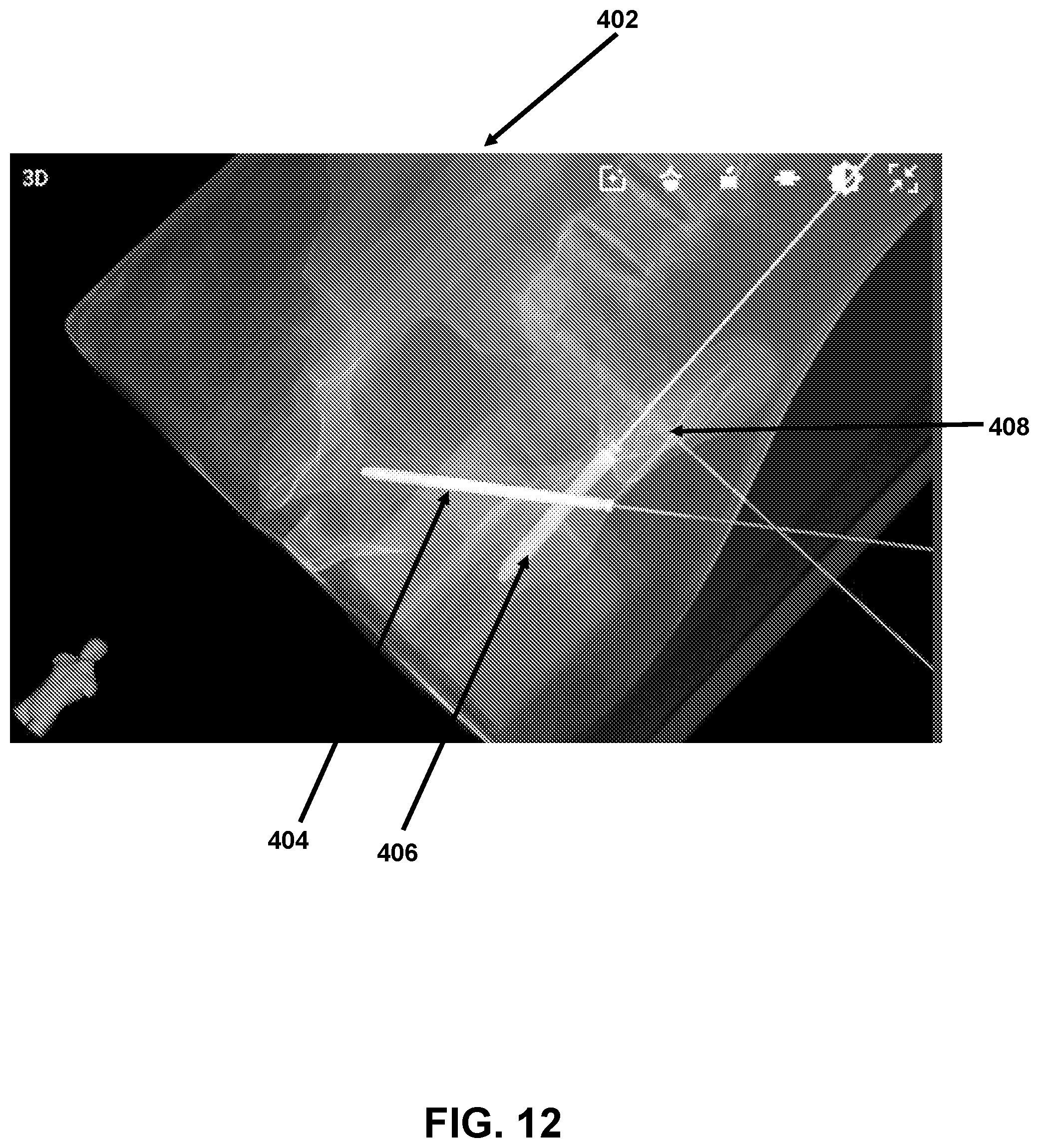 Patent US12426958 Figure 12 – Navigated pelvic implant system and associated method of use