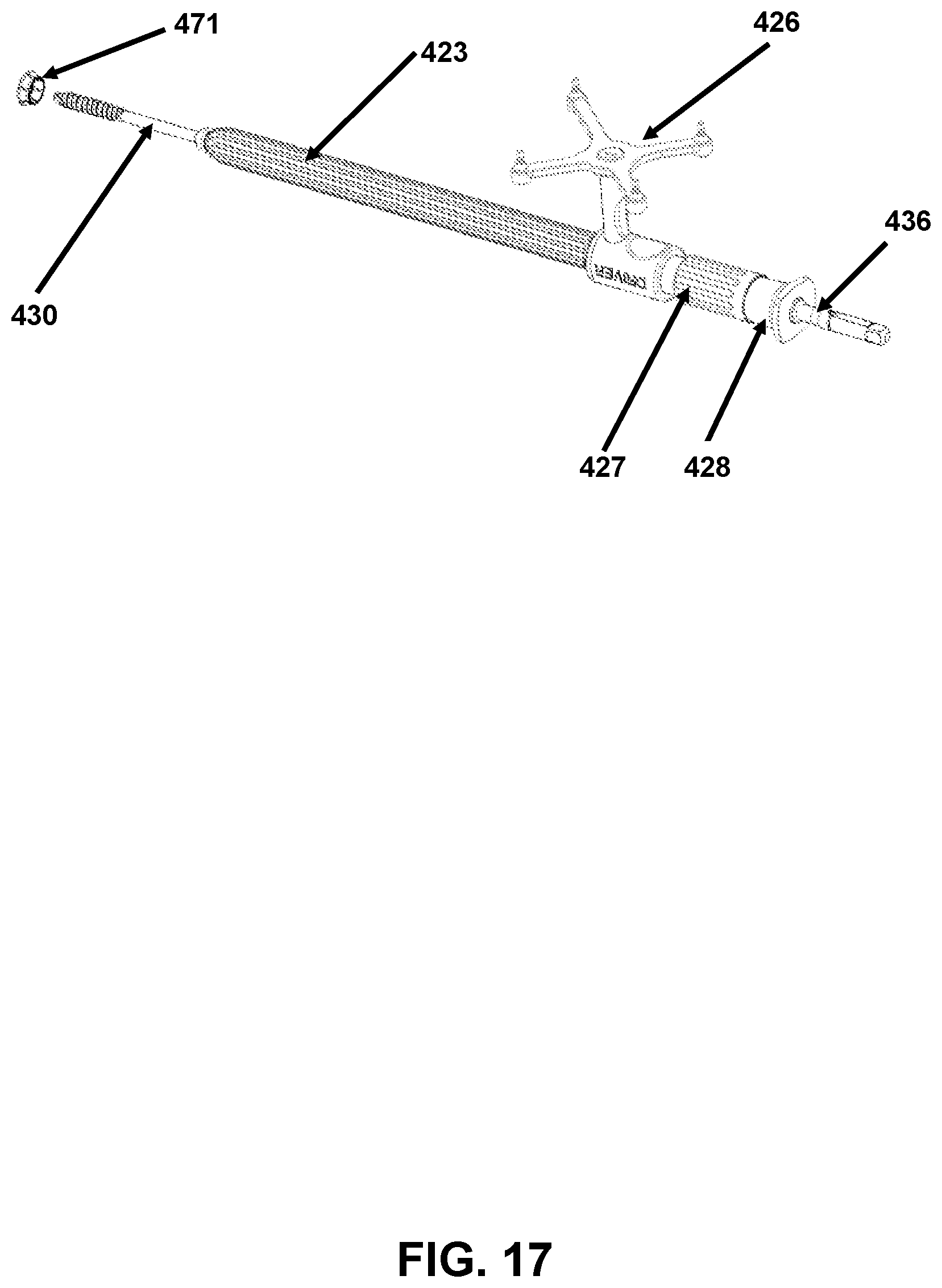 Patent US12426958 Figure 17 – Navigated pelvic implant system and associated method of use