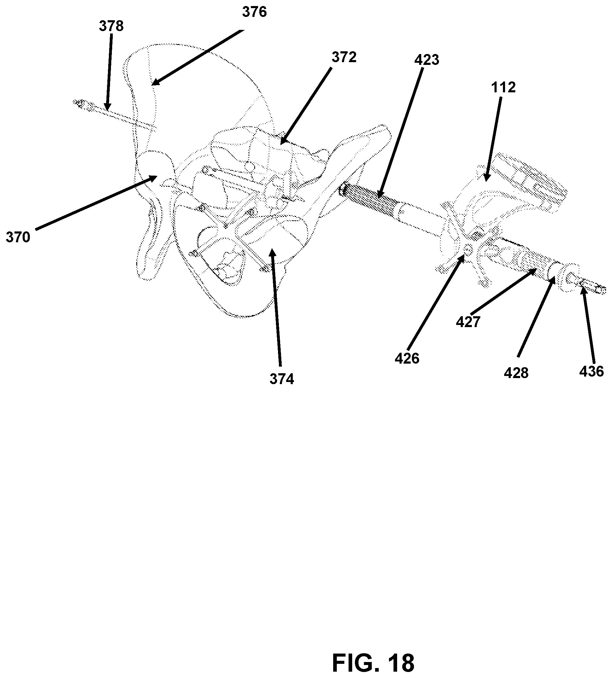 Patent US12426958 Figure 18 – Navigated pelvic implant system and associated method of use