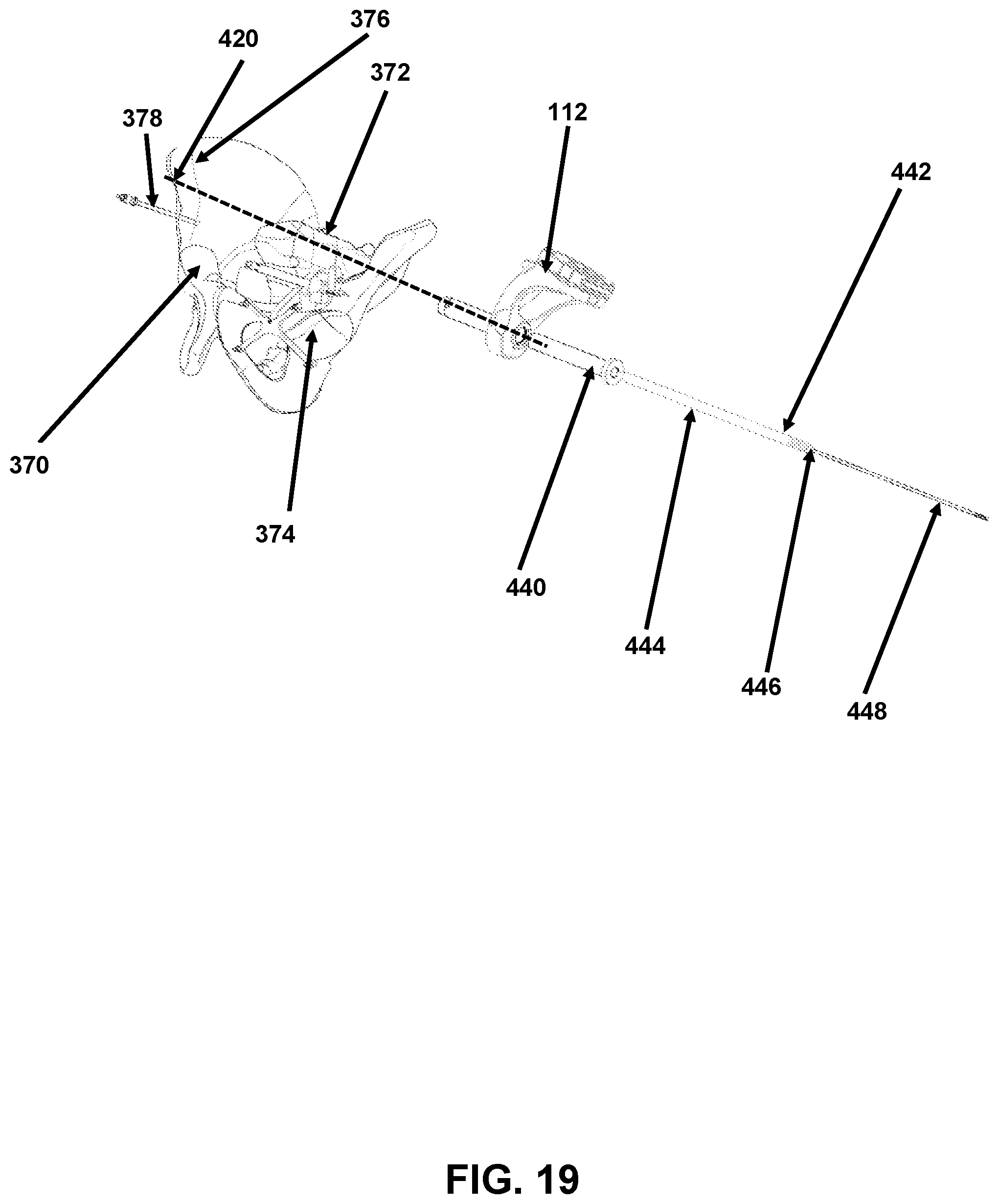 Patent US12426958 Figure 19 – Navigated pelvic implant system and associated method of use
