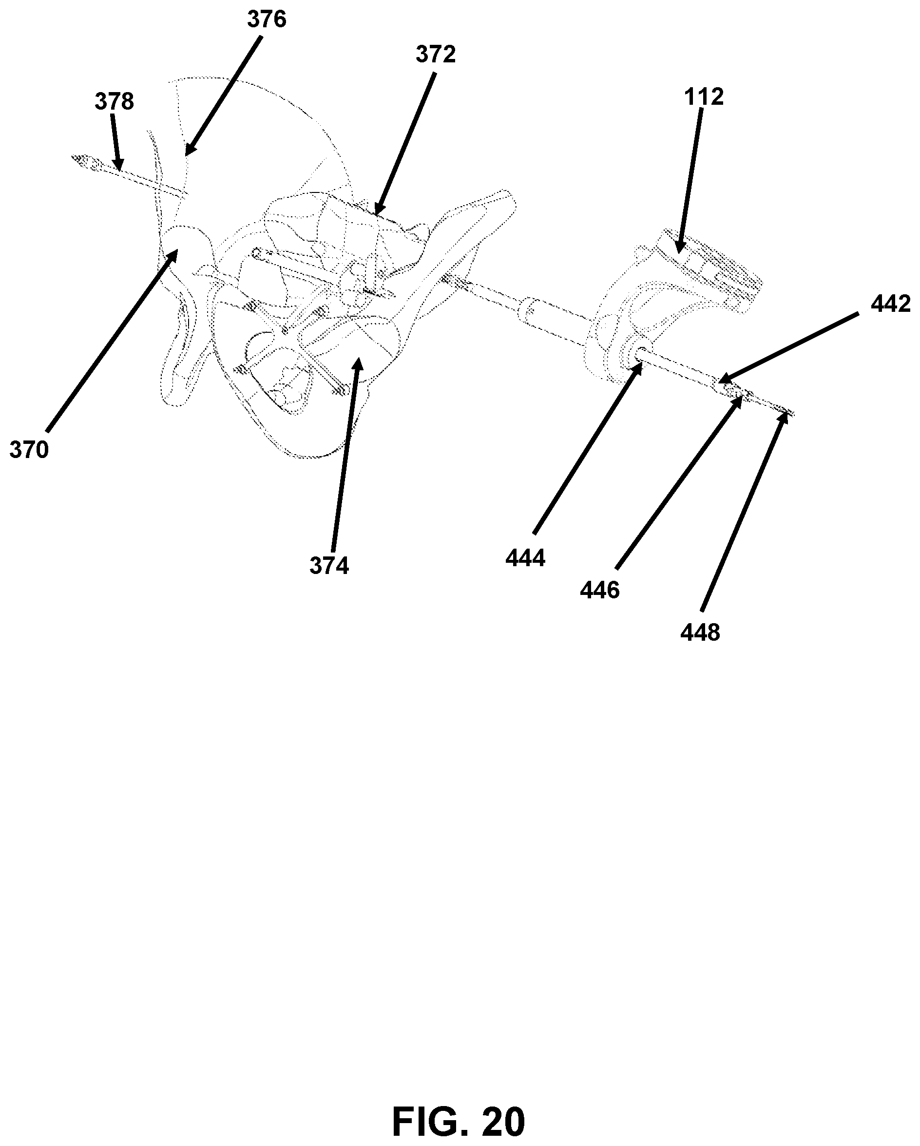 Patent US12426958 Figure 20 – Navigated pelvic implant system and associated method of use