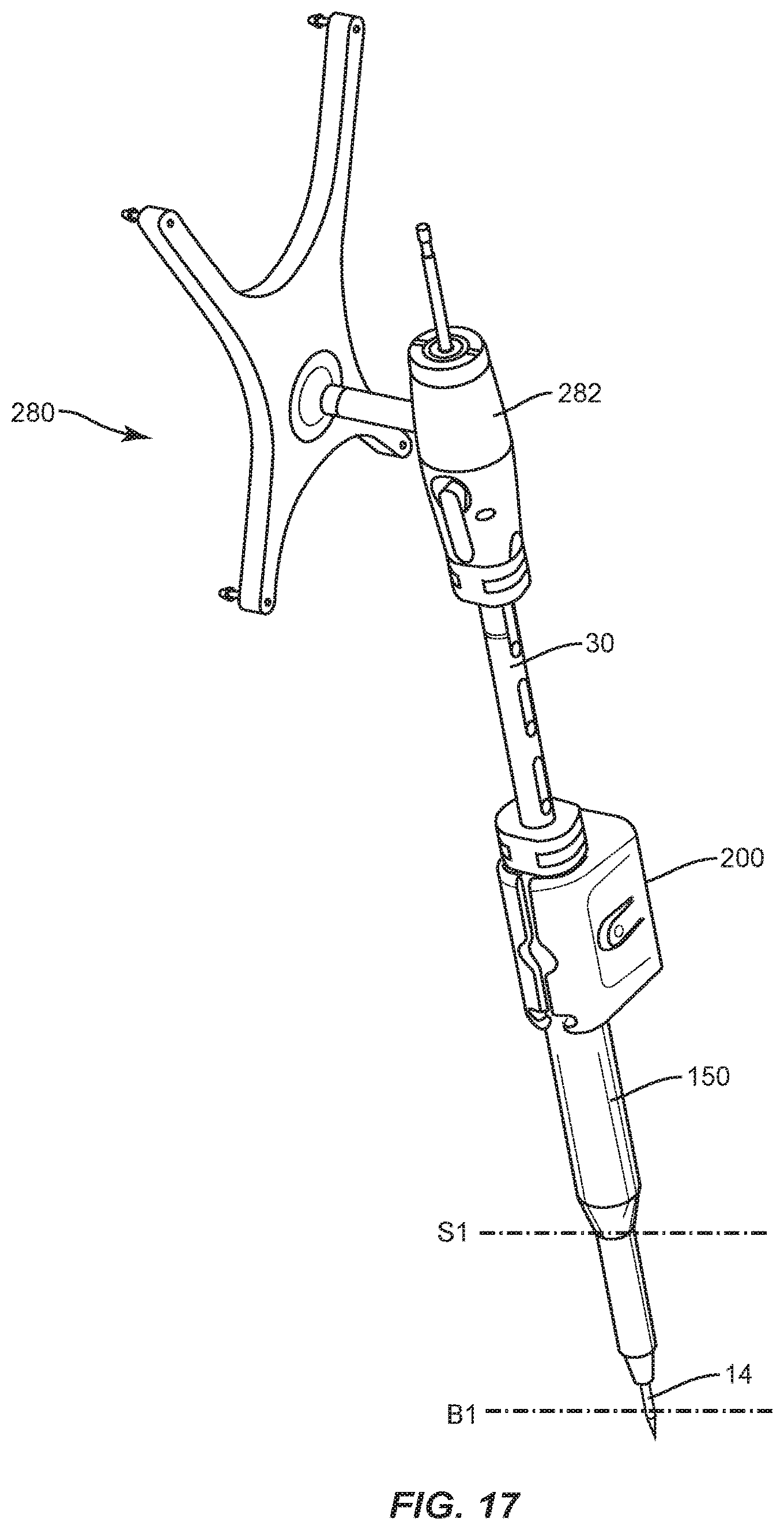 Patent US12426959 Figure 9 – Spinal implant system and method