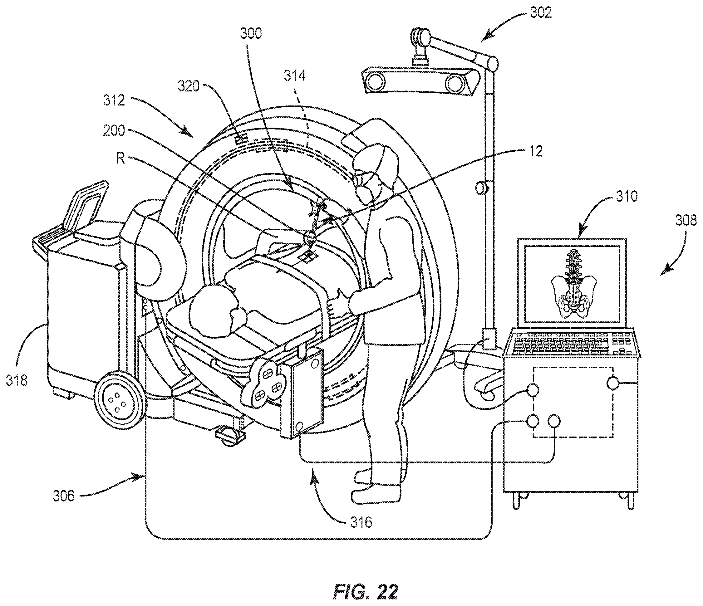 Patent US12426959 Figure 12 – Spinal implant system and method