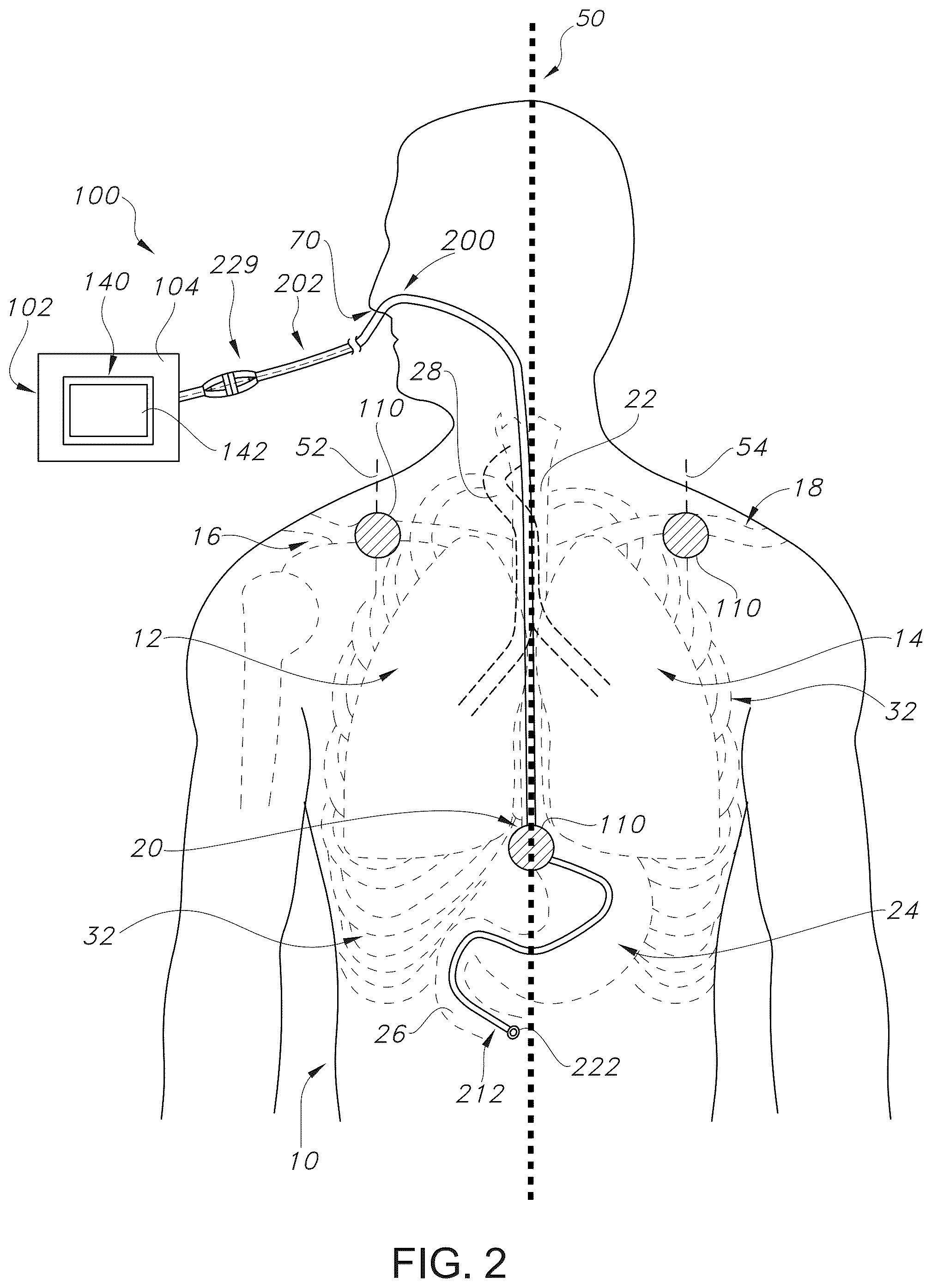 Patent US12426960 Figure 2 – Medical device position notification system