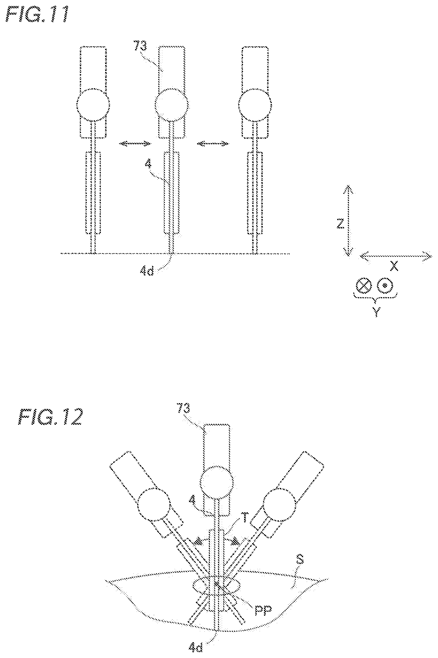 Patent US12426968 Figure 7 – Robotic surgical system and method for setting pivot position