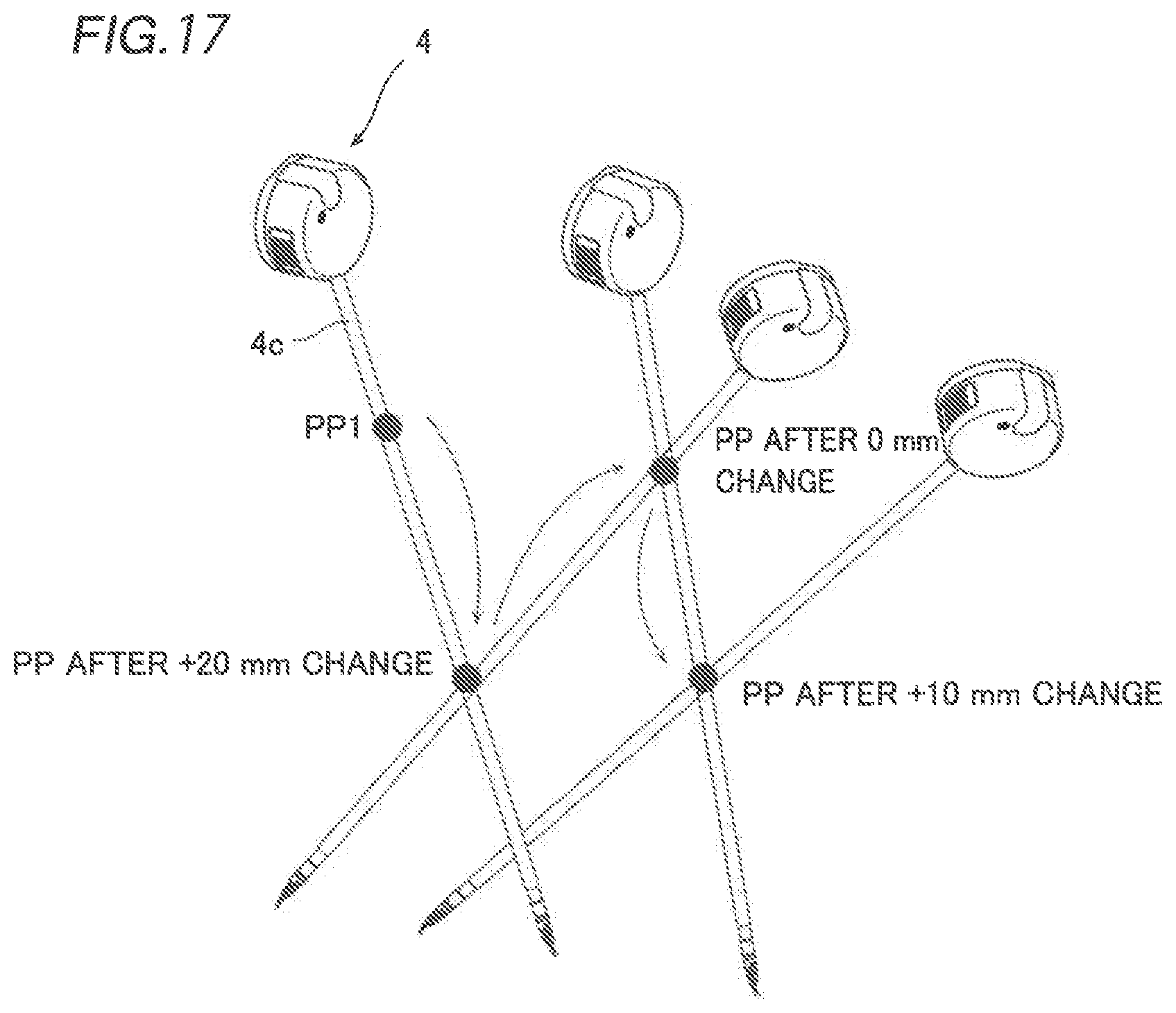 Patent US12426968 Figure 11 – Robotic surgical system and method for setting pivot position