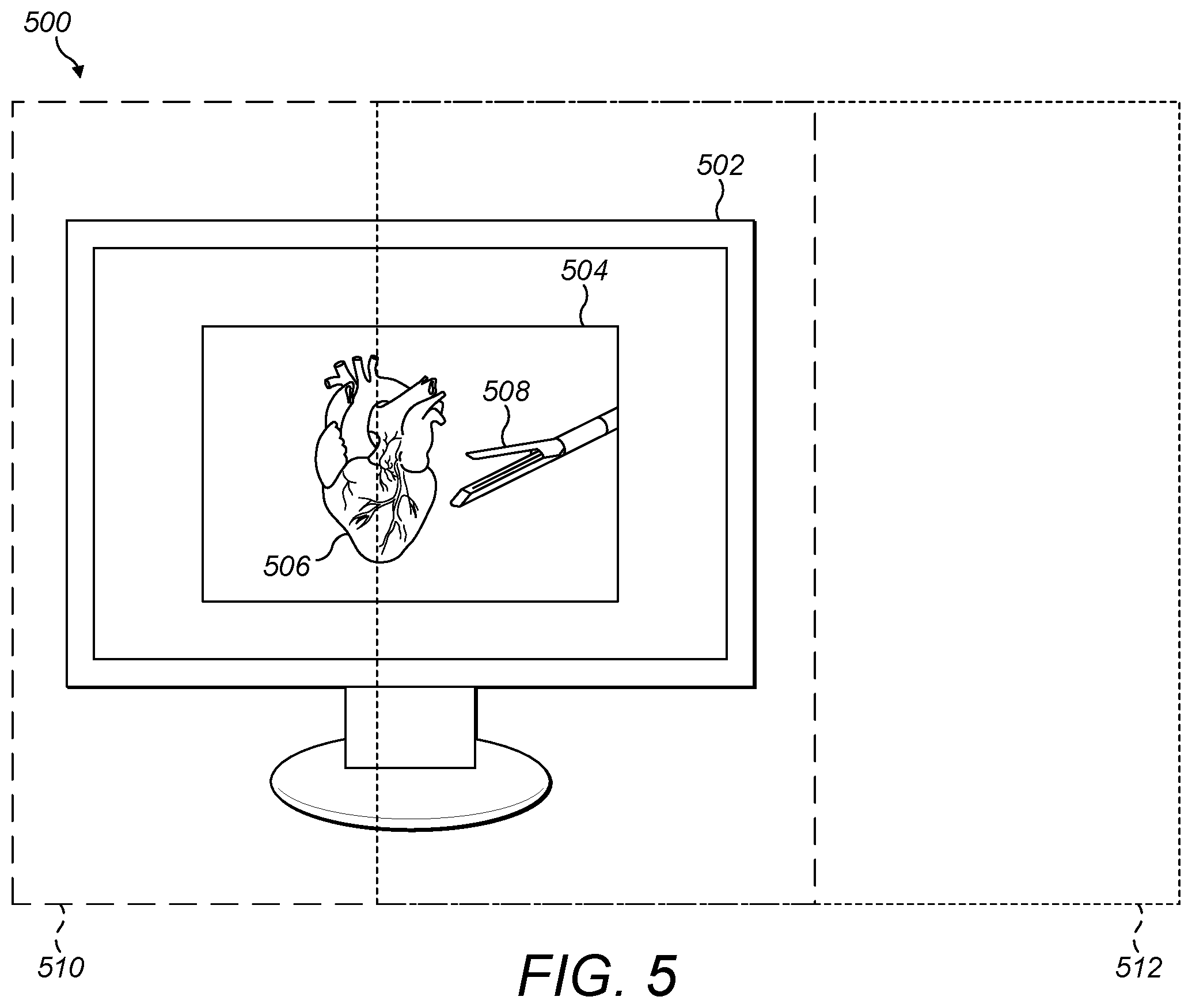 Patent US12426977 Figure 5 – Virtual console for controlling a surgical robot