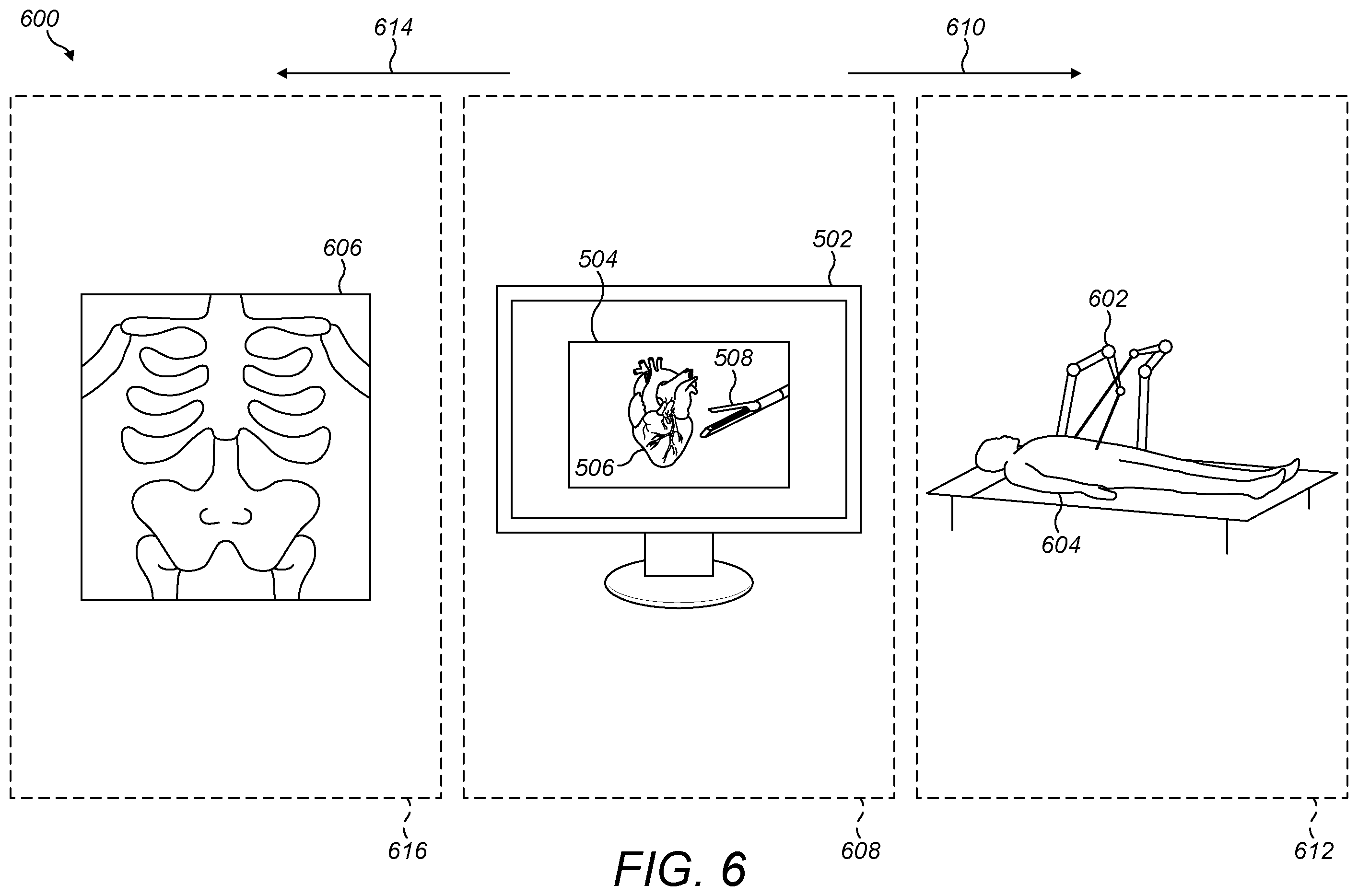 Patent US12426977 Figure 6 – Virtual console for controlling a surgical robot