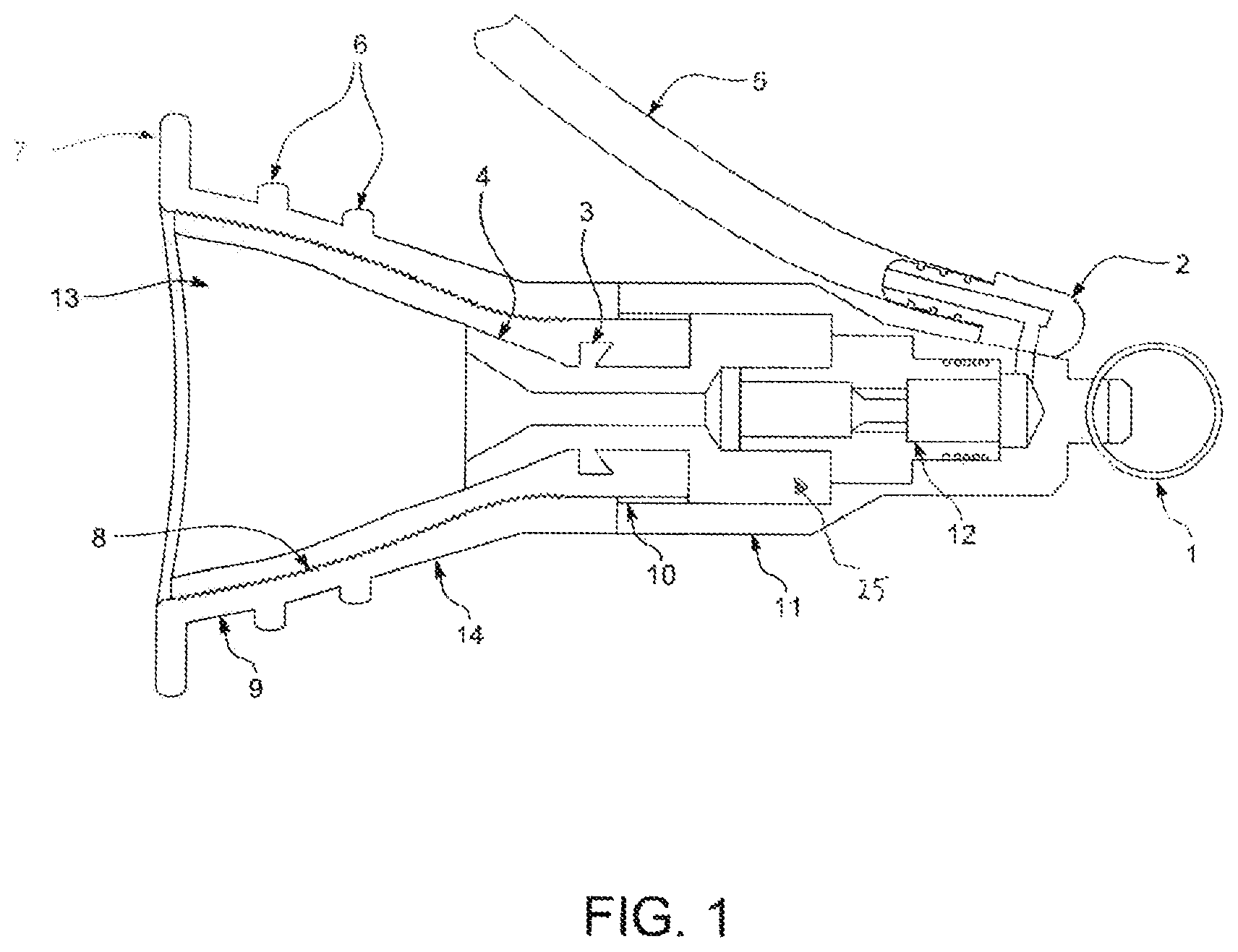 Patent US12426979 Figure 1 – Foreskin reconstruction and restoration methods and devices