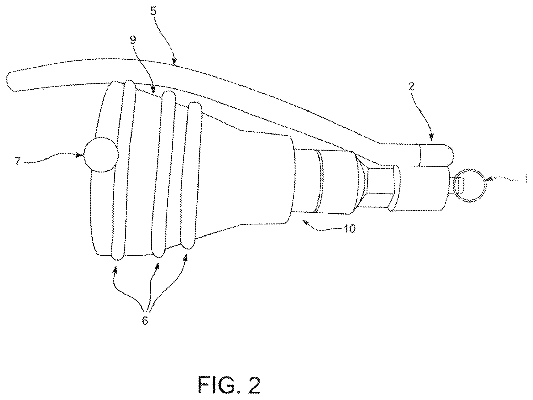 Patent US12426979 Figure 2 – Foreskin reconstruction and restoration methods and devices