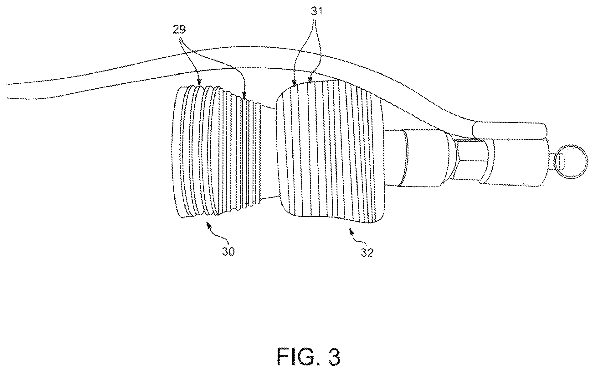 Patent US12426979 Figure 3 – Foreskin reconstruction and restoration methods and devices