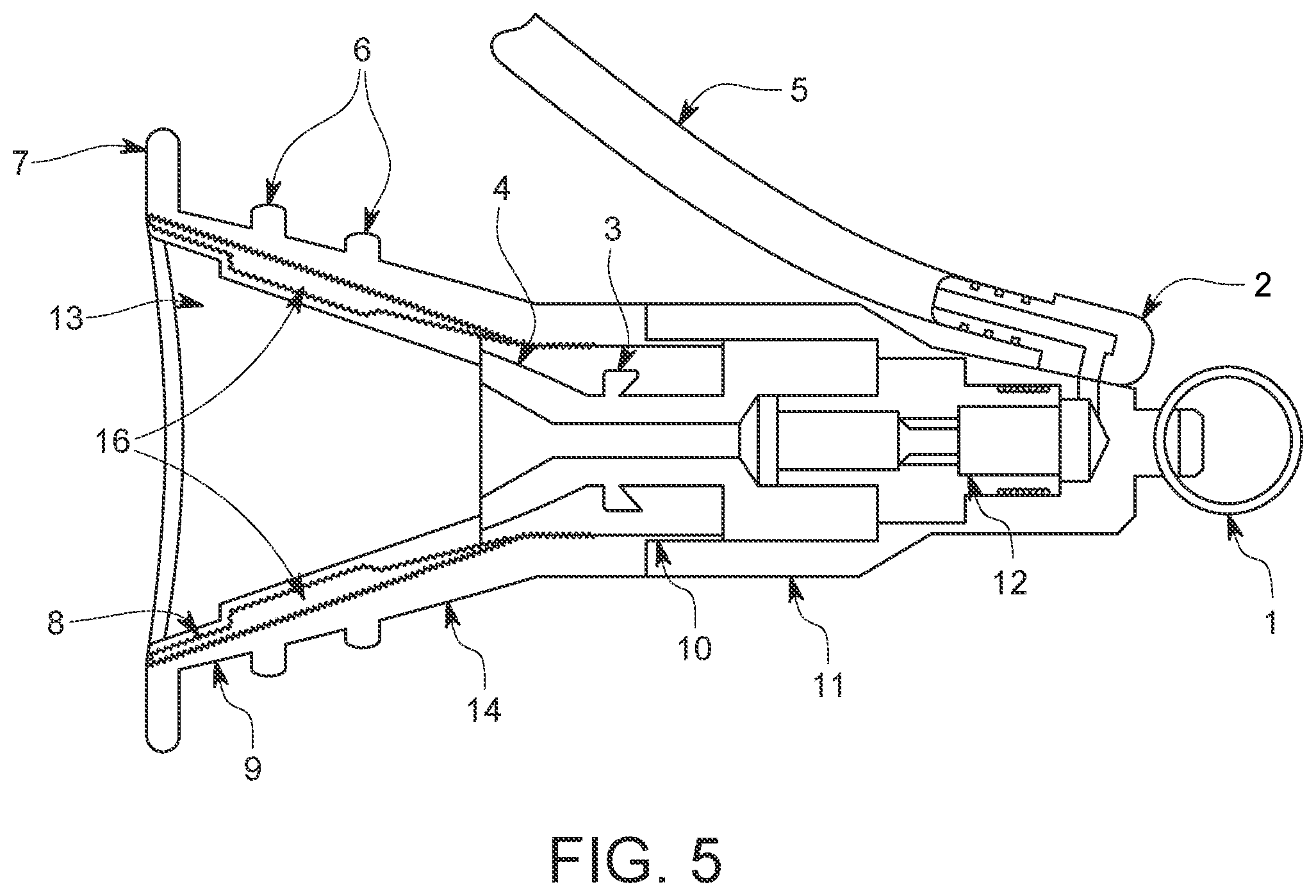 Patent US12426979 Figure 5 – Foreskin reconstruction and restoration methods and devices