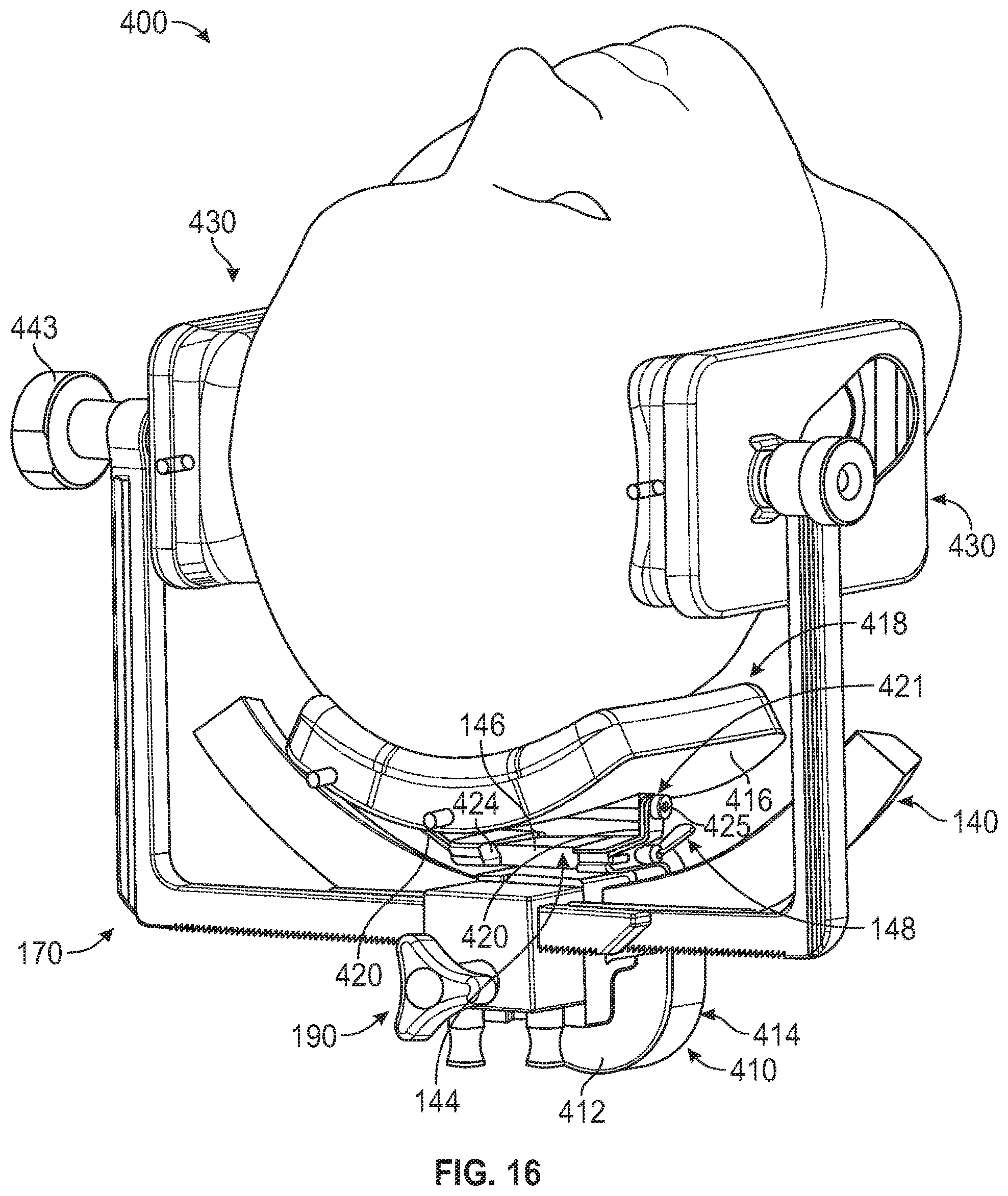 Patent US12426983 Figure 13 – Head stabilization system and method with arc features