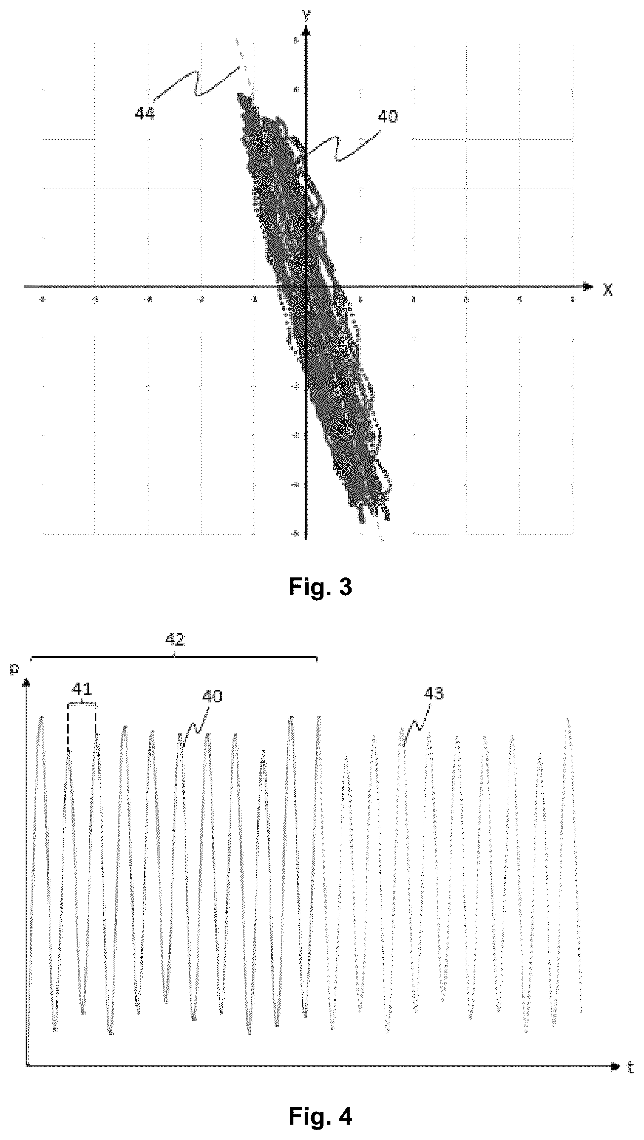 Patent US12426984 Figure 2 – Augmented-reality navigation system for a medical robot
