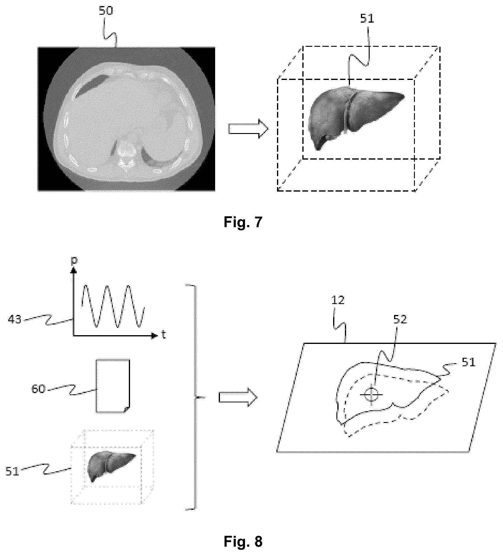 Patent US12426984 Figure 4 – Augmented-reality navigation system for a medical robot