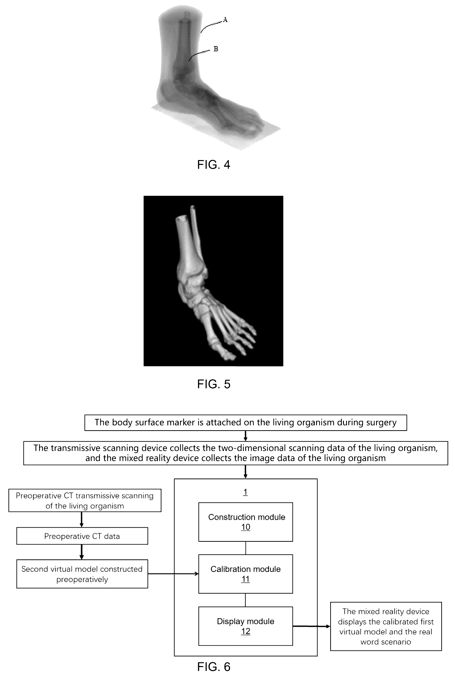Patent US12426985 Figure 3 – Display device and system for three-dimensional virtual model of living organism, and mixed reality device