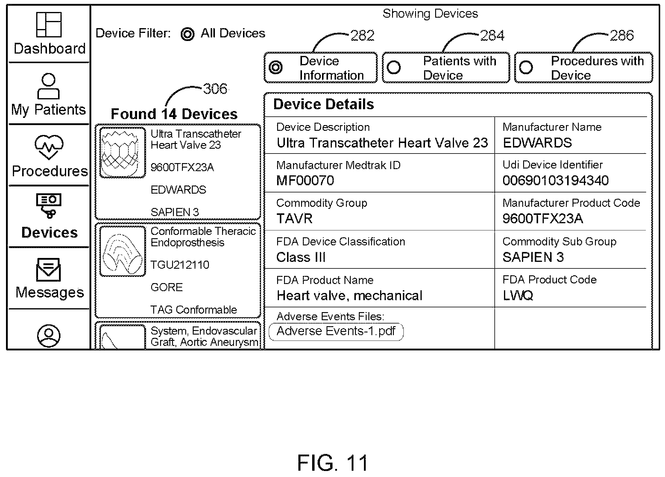 Patent US12426987 Figure 11 – Medical implant tracking system