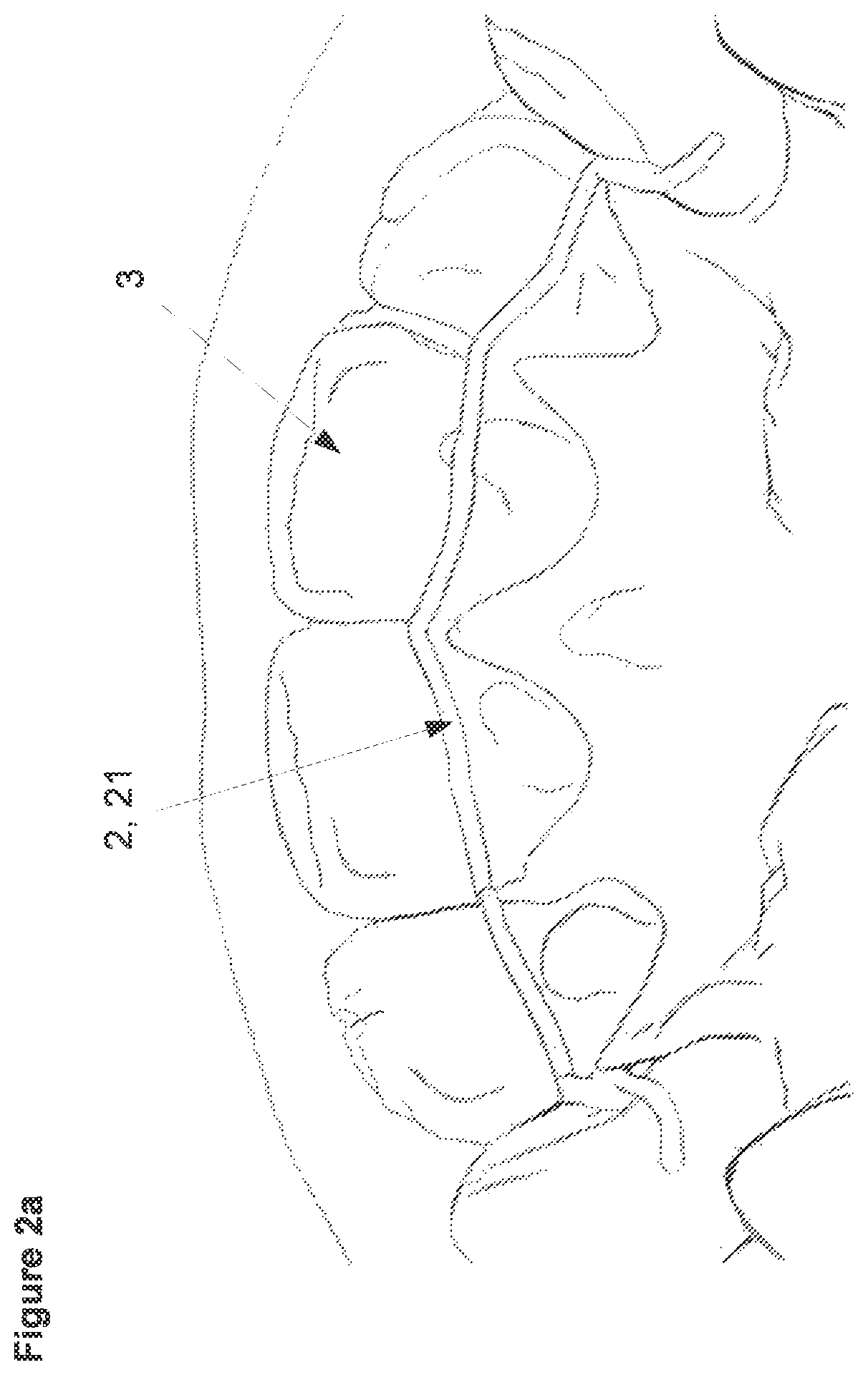 Patent US12426988 Figure 2 – Three-dimensional orthodontic retainer and method for making a three-dimensional orthodontic retainer