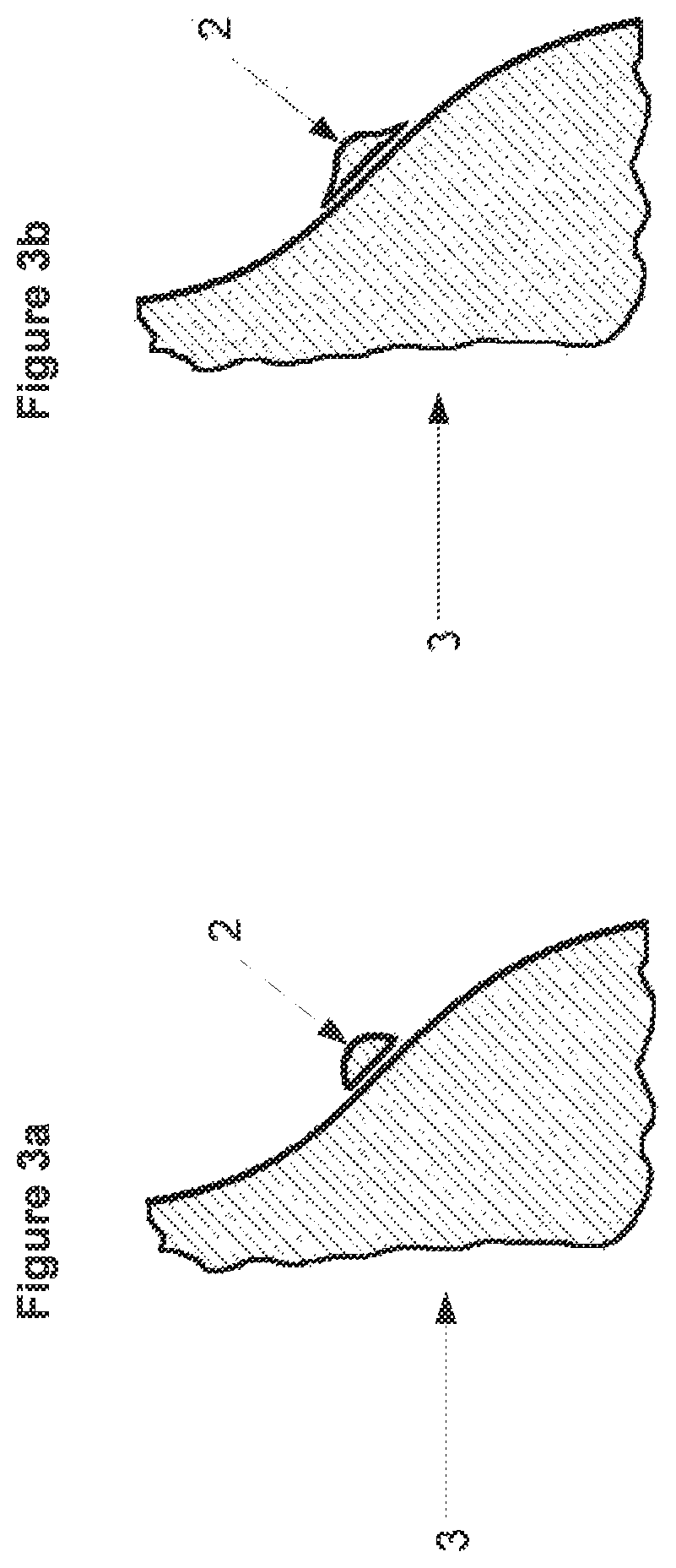 Patent US12426988 Figure 4 – Three-dimensional orthodontic retainer and method for making a three-dimensional orthodontic retainer
