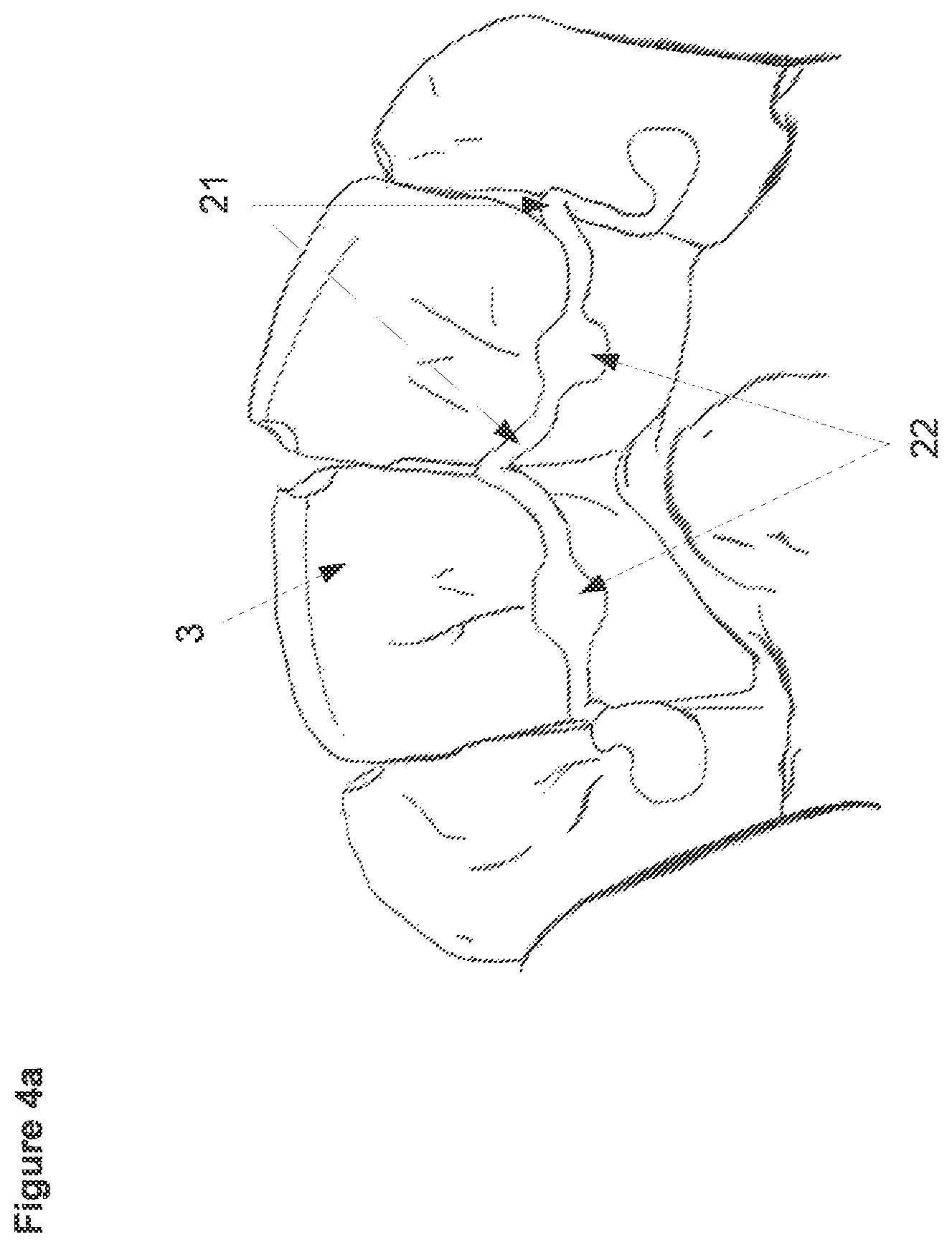 Patent US12426988 Figure 5 – Three-dimensional orthodontic retainer and method for making a three-dimensional orthodontic retainer