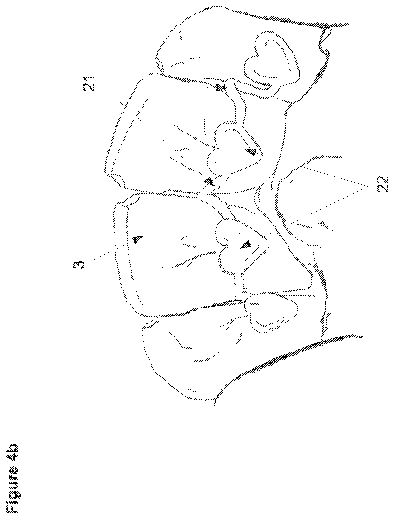 Patent US12426988 Figure 6 – Three-dimensional orthodontic retainer and method for making a three-dimensional orthodontic retainer
