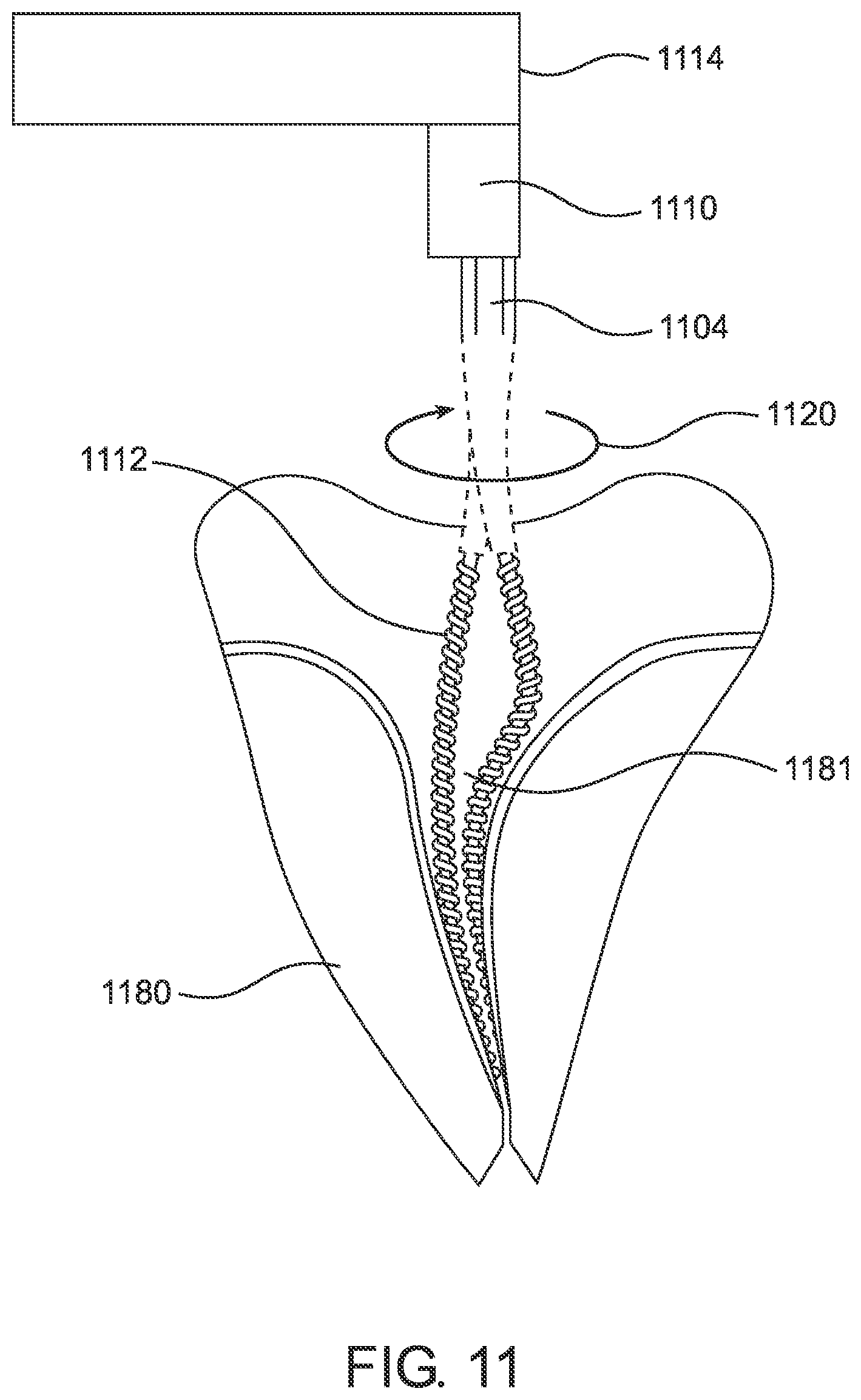 Patent US12426990 Figure 11 – Handpiece adapter for an endodontic file