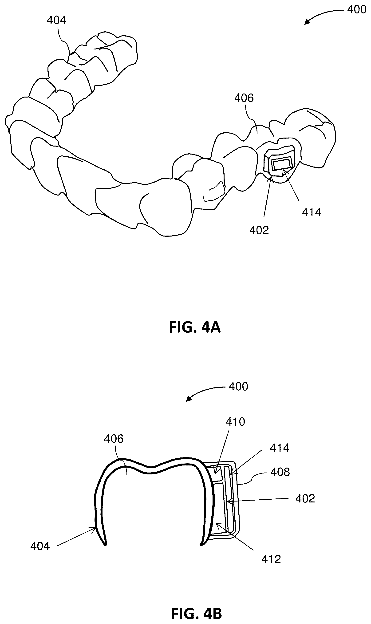 Patent US12426992 Figure 4 – Systems including orthodontic appliance cases and methods of use
