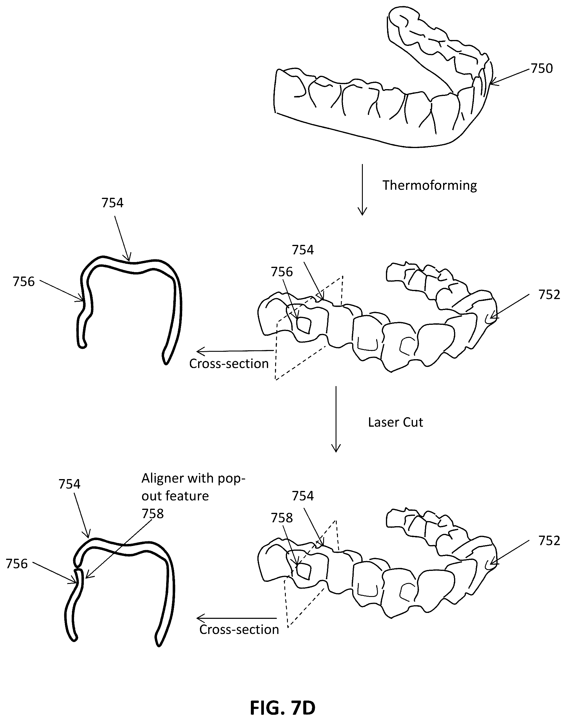 Patent US12426992 Figure 8 – Systems including orthodontic appliance cases and methods of use