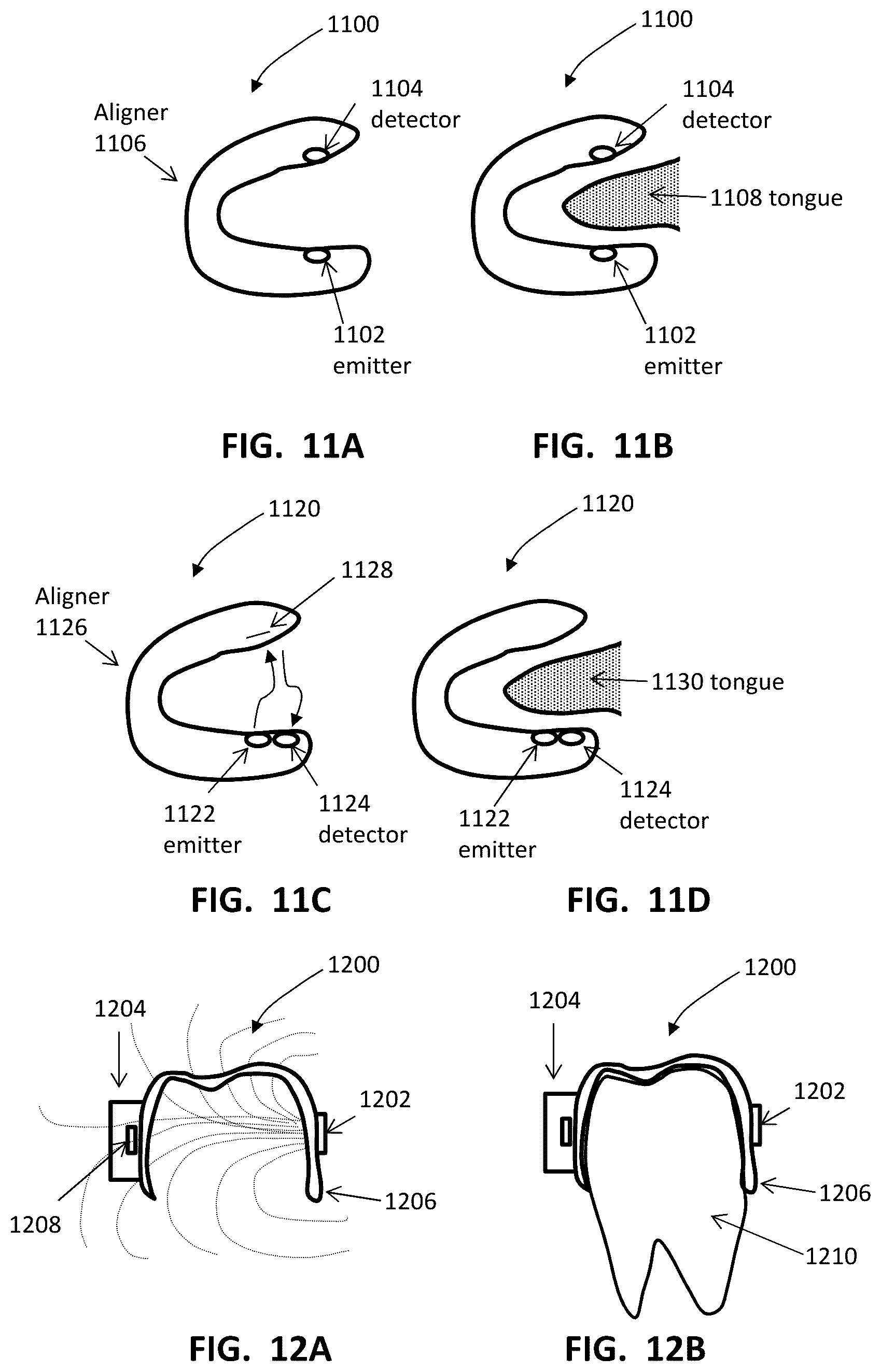 Patent US12426992 Figure 12 – Systems including orthodontic appliance cases and methods of use