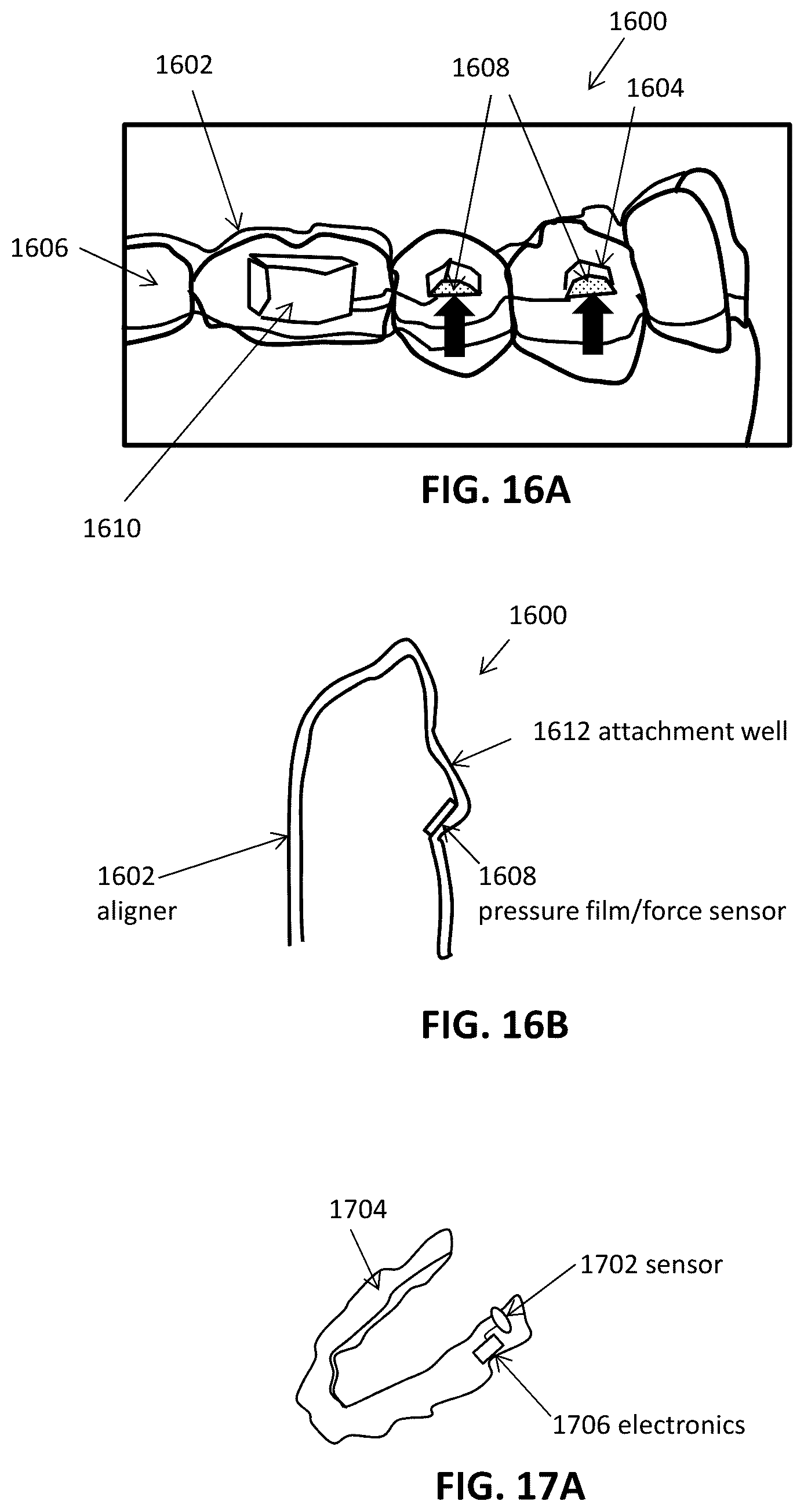 Patent US12426992 Figure 15 – Systems including orthodontic appliance cases and methods of use