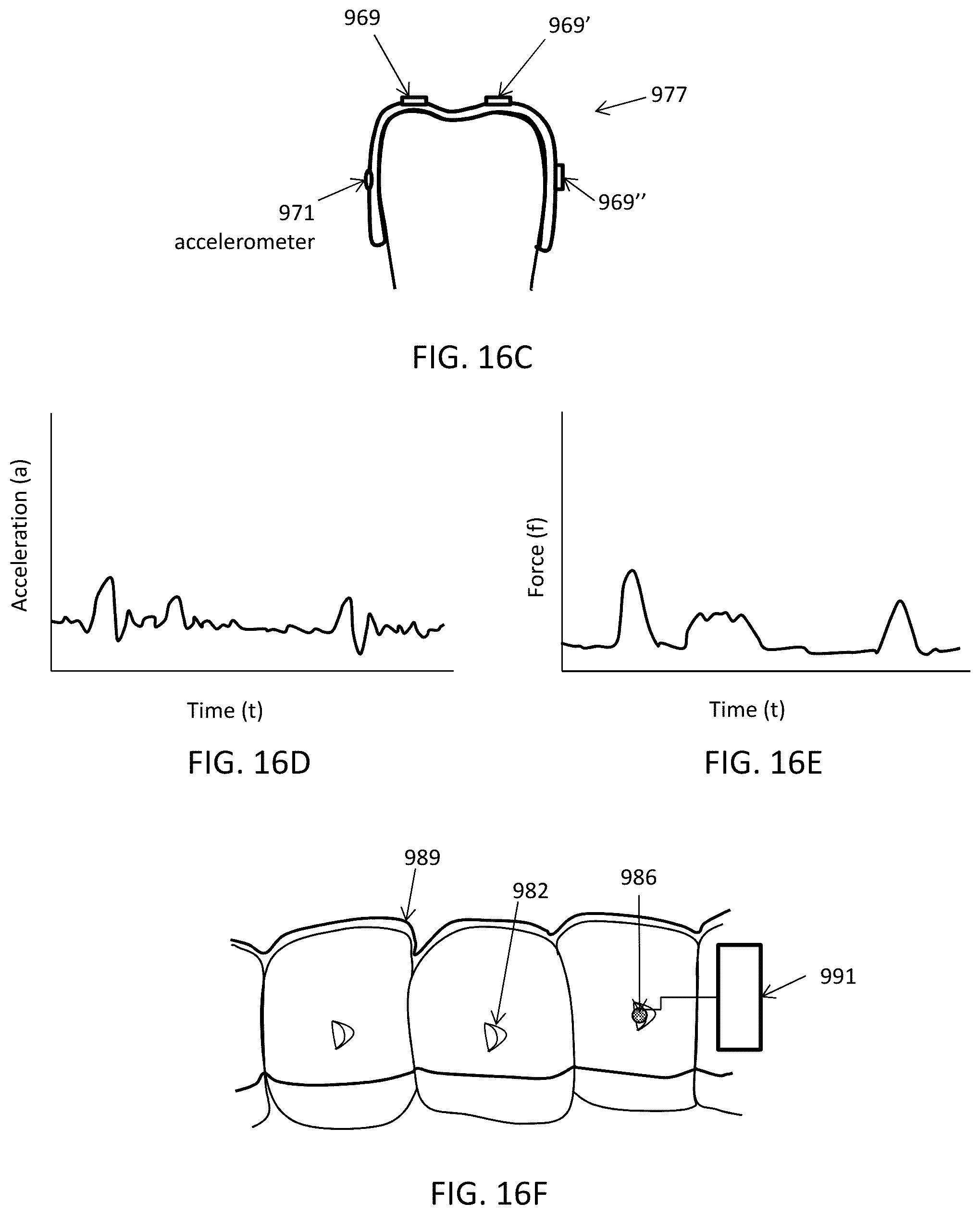 Patent US12426992 Figure 16 – Systems including orthodontic appliance cases and methods of use