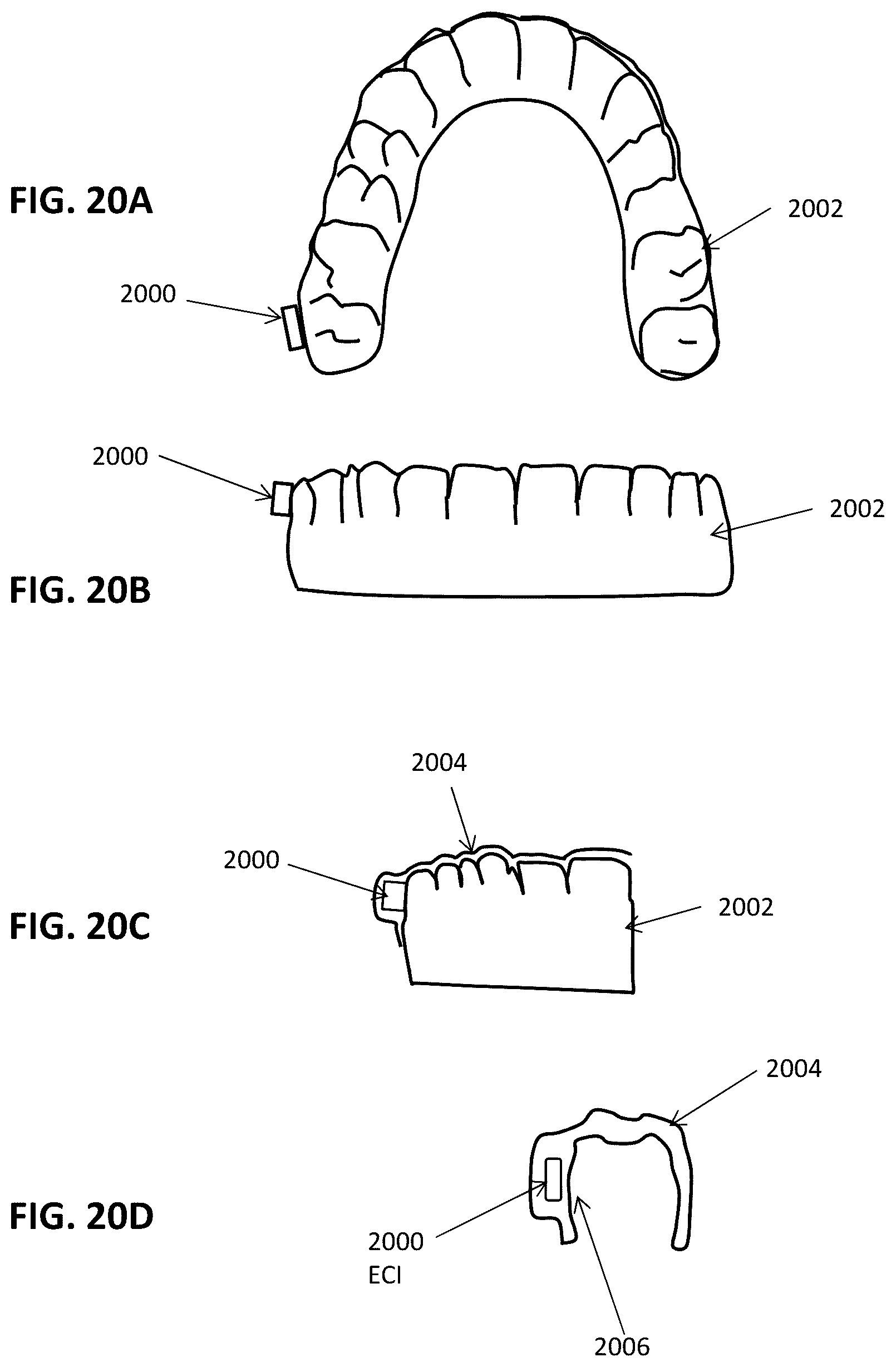 Patent US12426992 Figure 18 – Systems including orthodontic appliance cases and methods of use