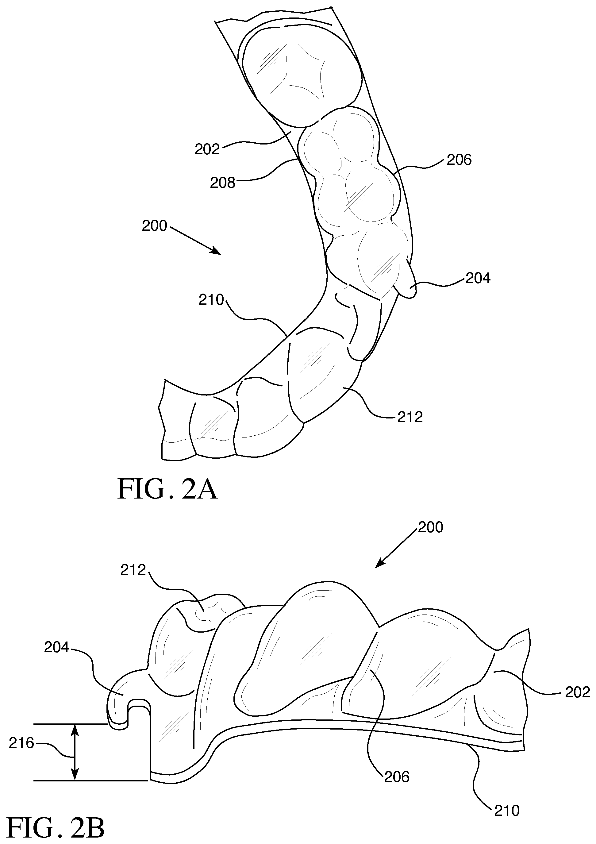 Patent US12426993 Figure 2 – Orthodontic aligner with built-in hook or traction device