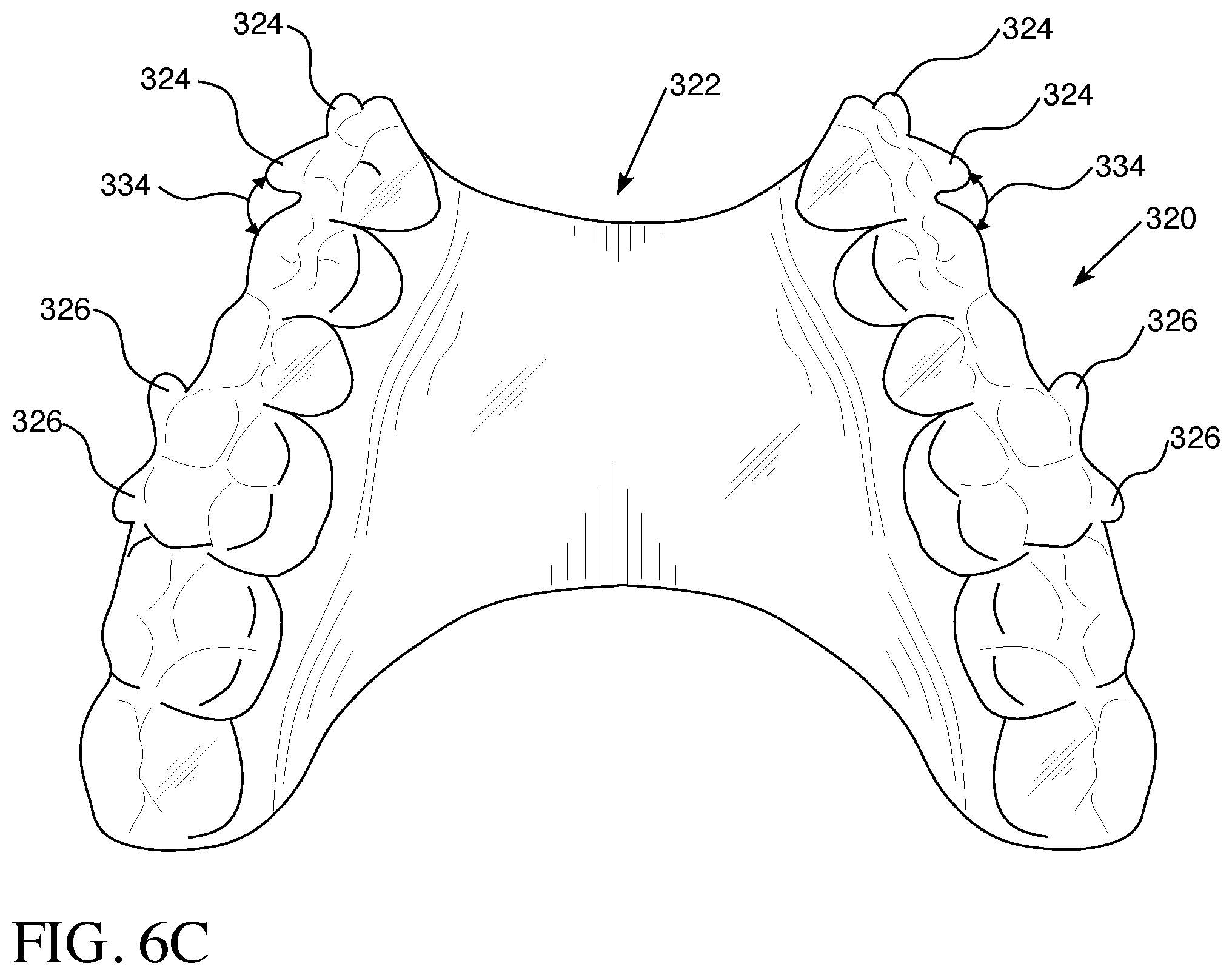 Patent US12426993 Figure 9 – Orthodontic aligner with built-in hook or traction device