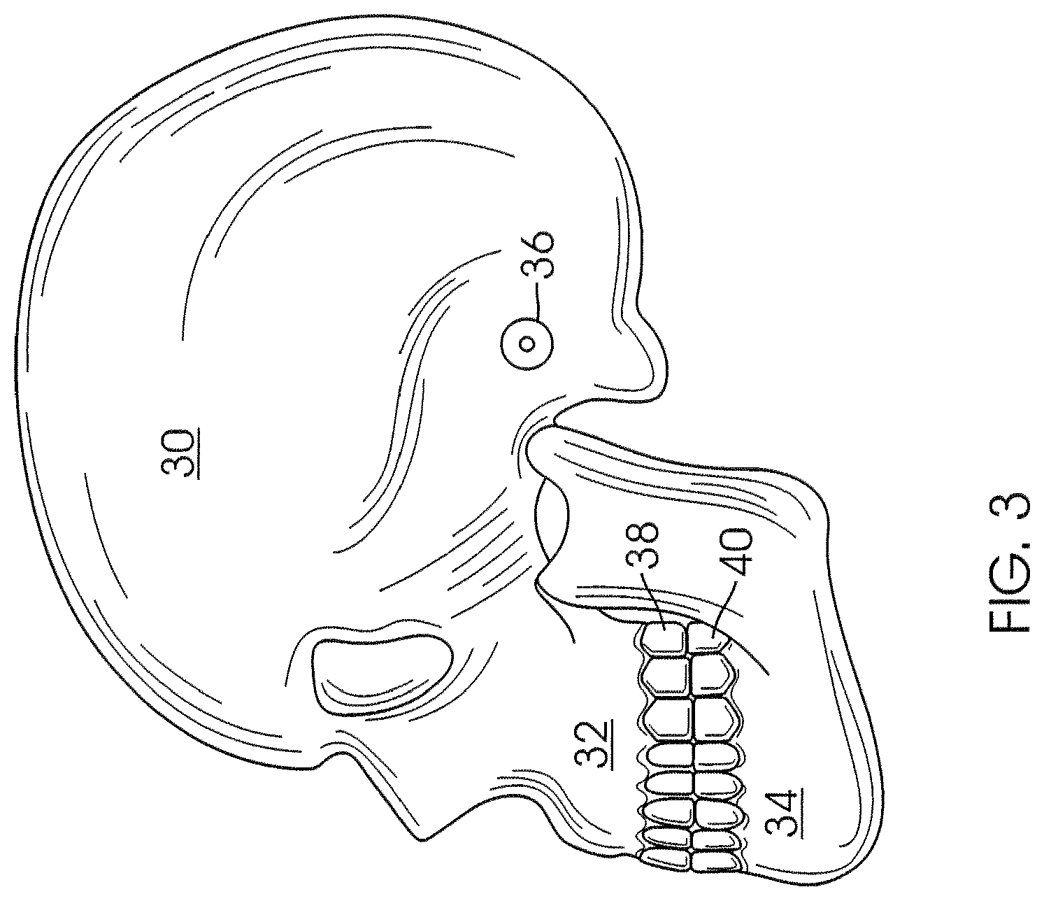 Patent US12426994 Figure 2 – Methods for generating dental models and appliances