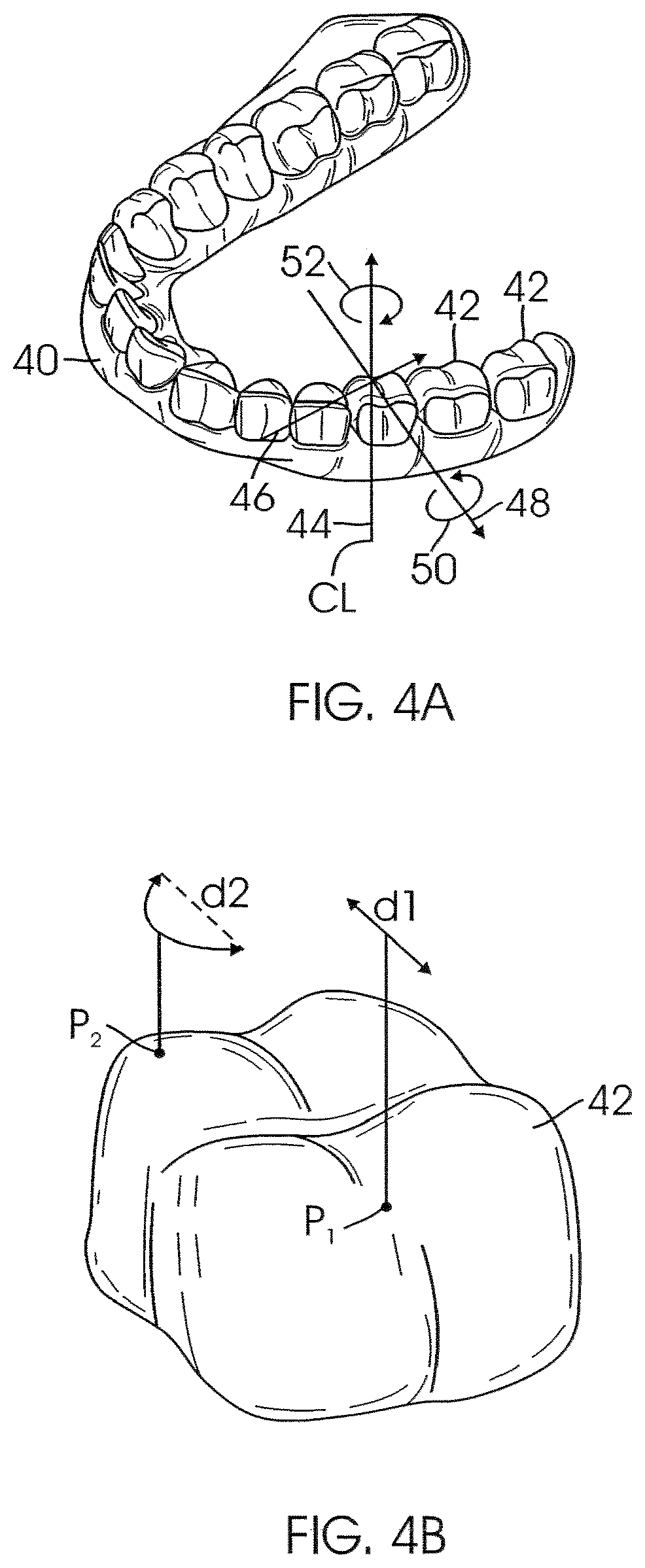 Patent US12426994 Figure 3 – Methods for generating dental models and appliances