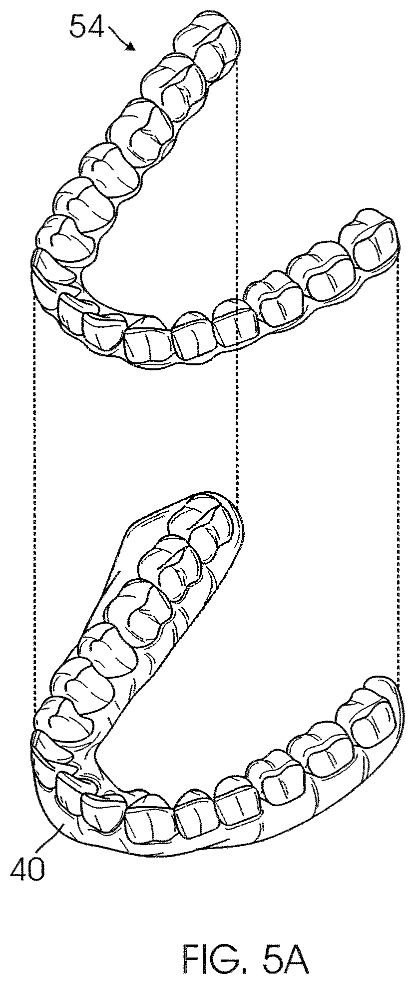 Patent US12426994 Figure 4 – Methods for generating dental models and appliances