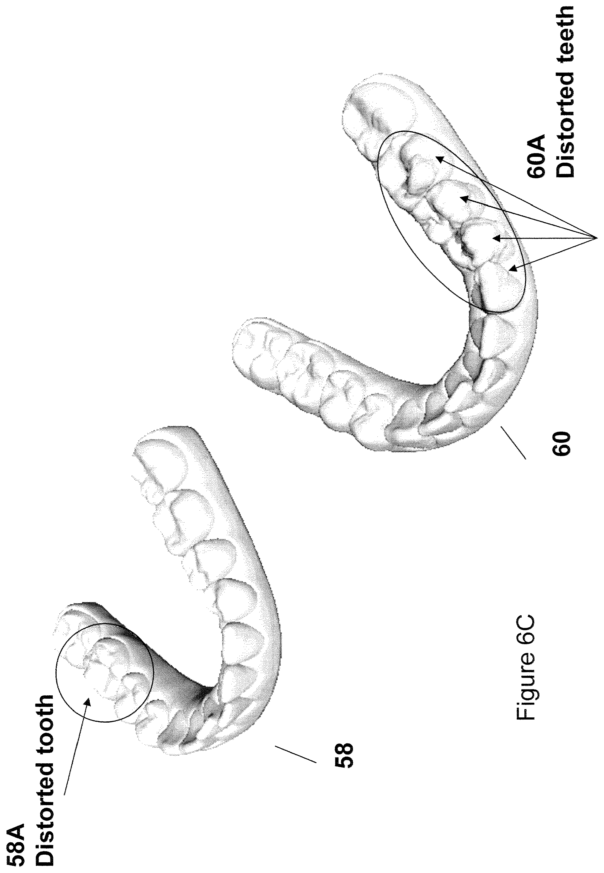 Patent US12426994 Figure 7 – Methods for generating dental models and appliances
