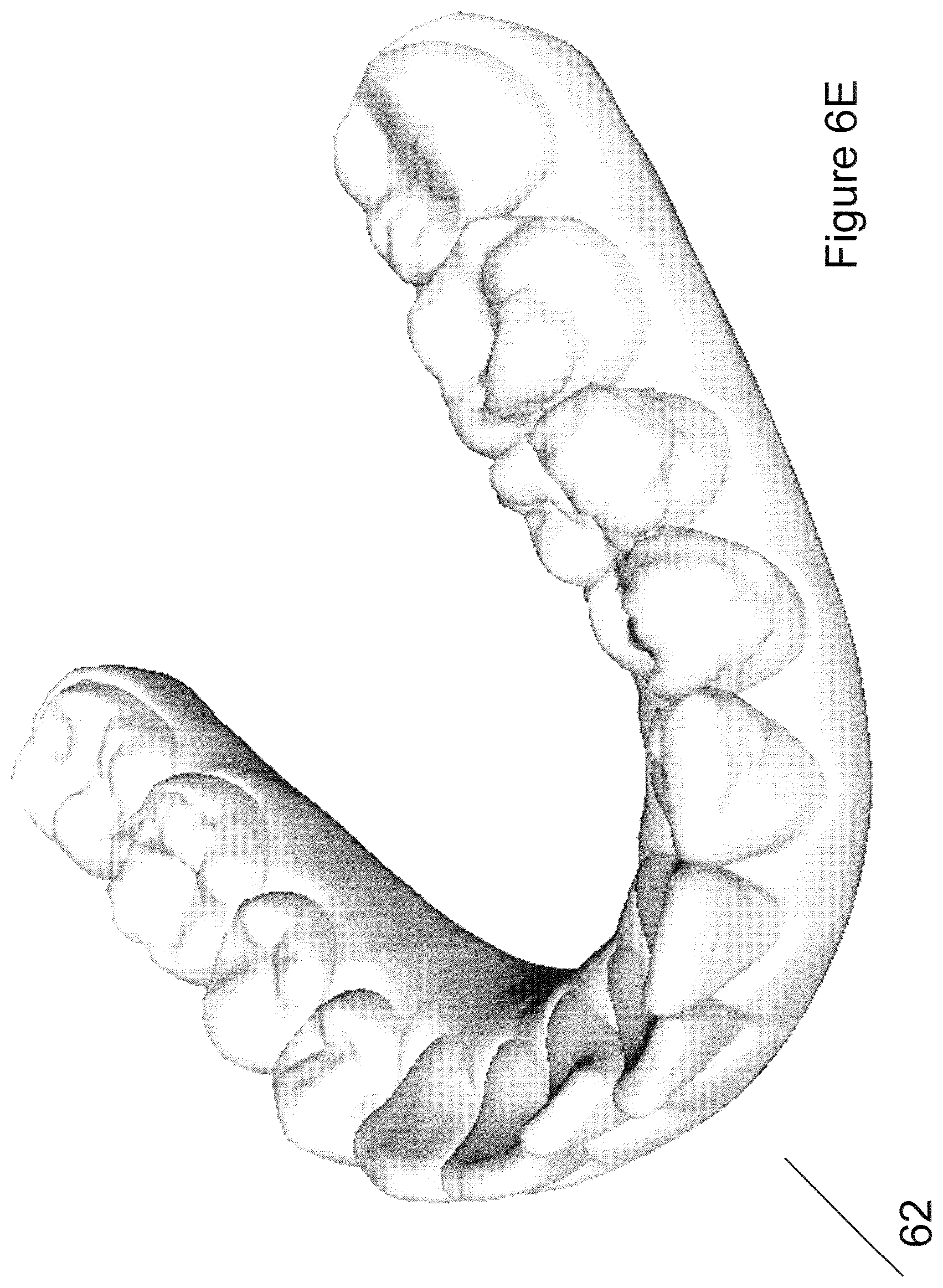 Patent US12426994 Figure 9 – Methods for generating dental models and appliances
