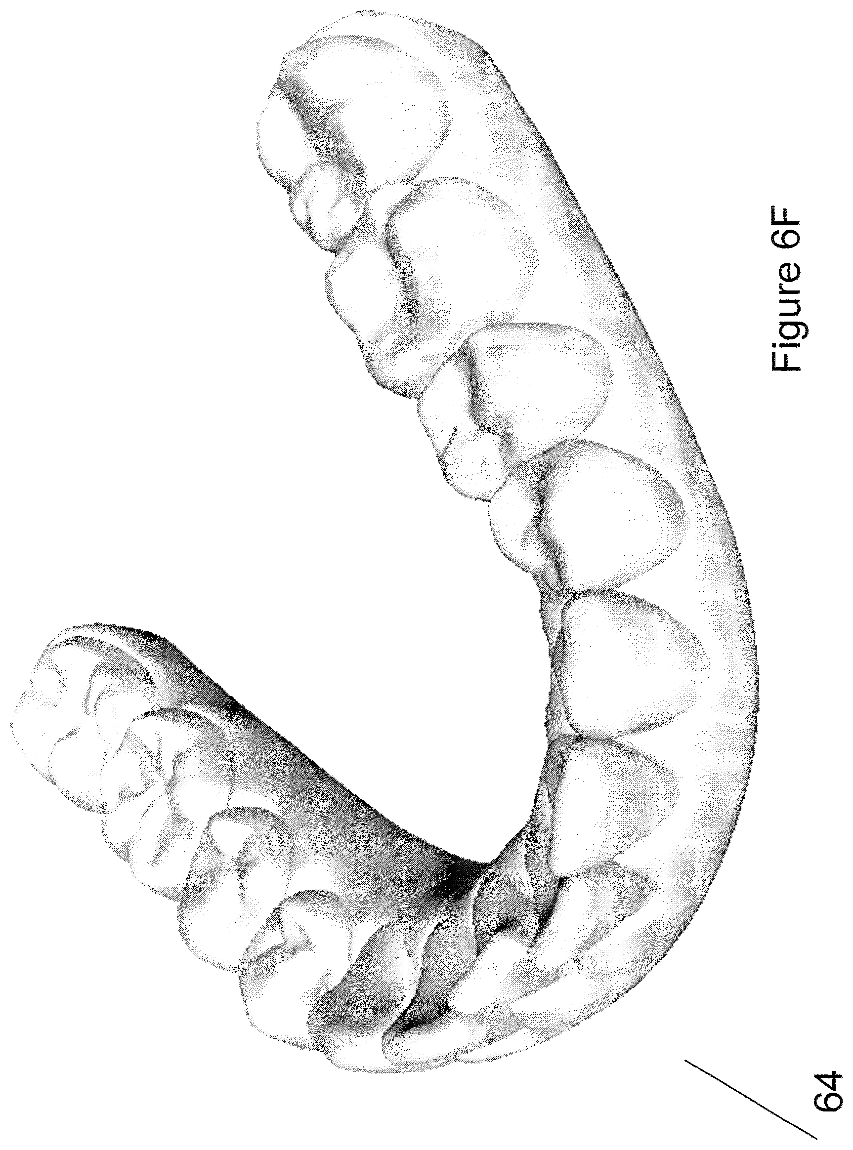 Patent US12426994 Figure 10 – Methods for generating dental models and appliances