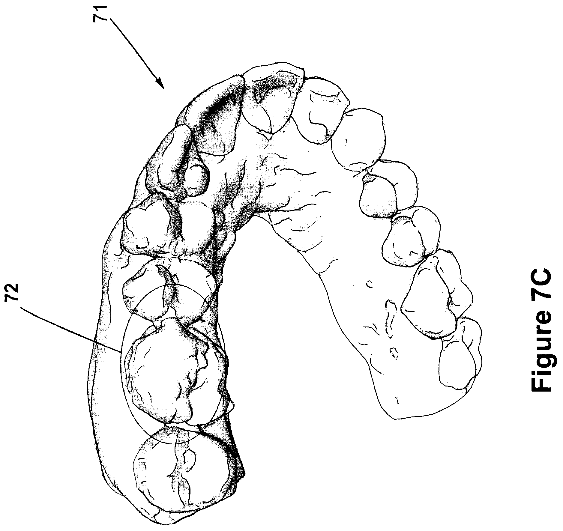 Patent US12426994 Figure 12 – Methods for generating dental models and appliances
