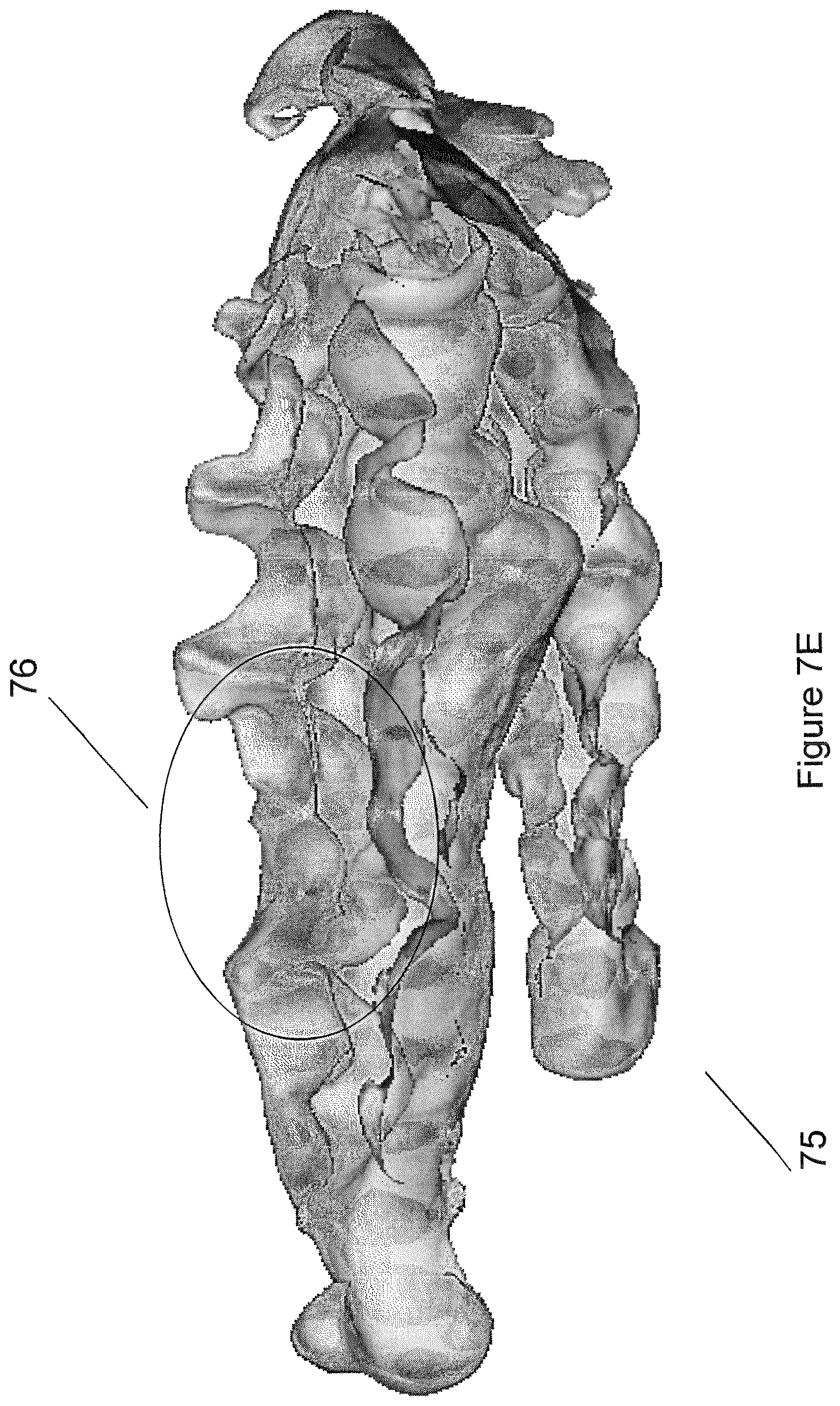 Patent US12426994 Figure 14 – Methods for generating dental models and appliances