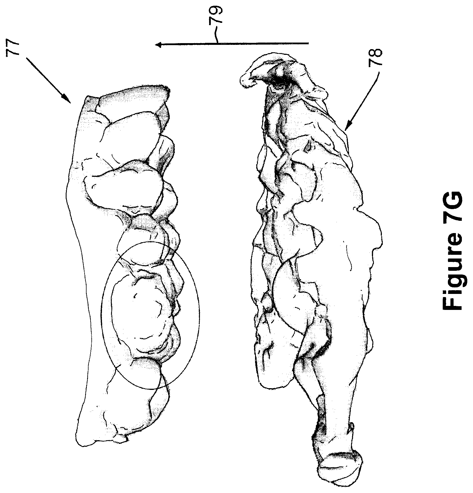 Patent US12426994 Figure 16 – Methods for generating dental models and appliances